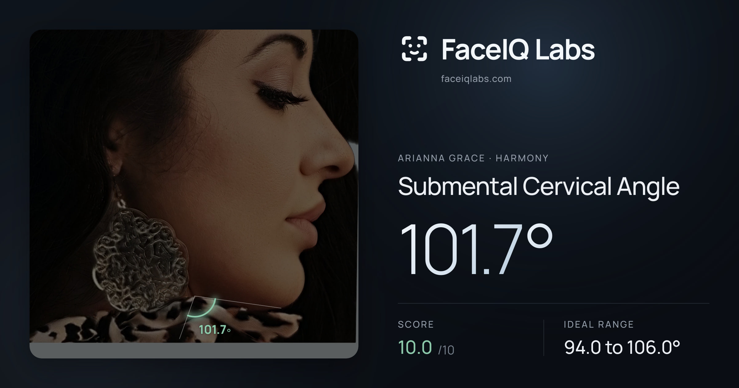 Arianna Grace Submental Cervical Angle: 101.7°, drawn on the photo