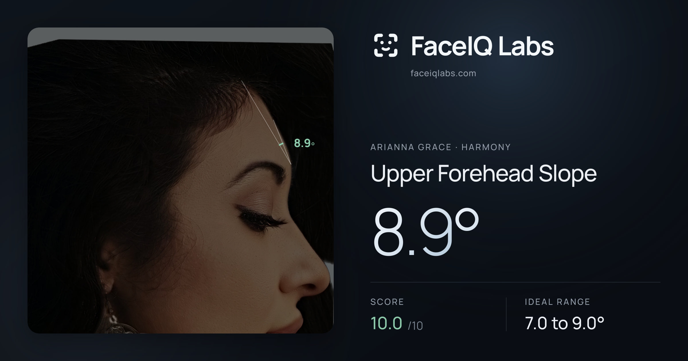 Arianna Grace Upper Forehead Slope: 8.9°, drawn on the photo