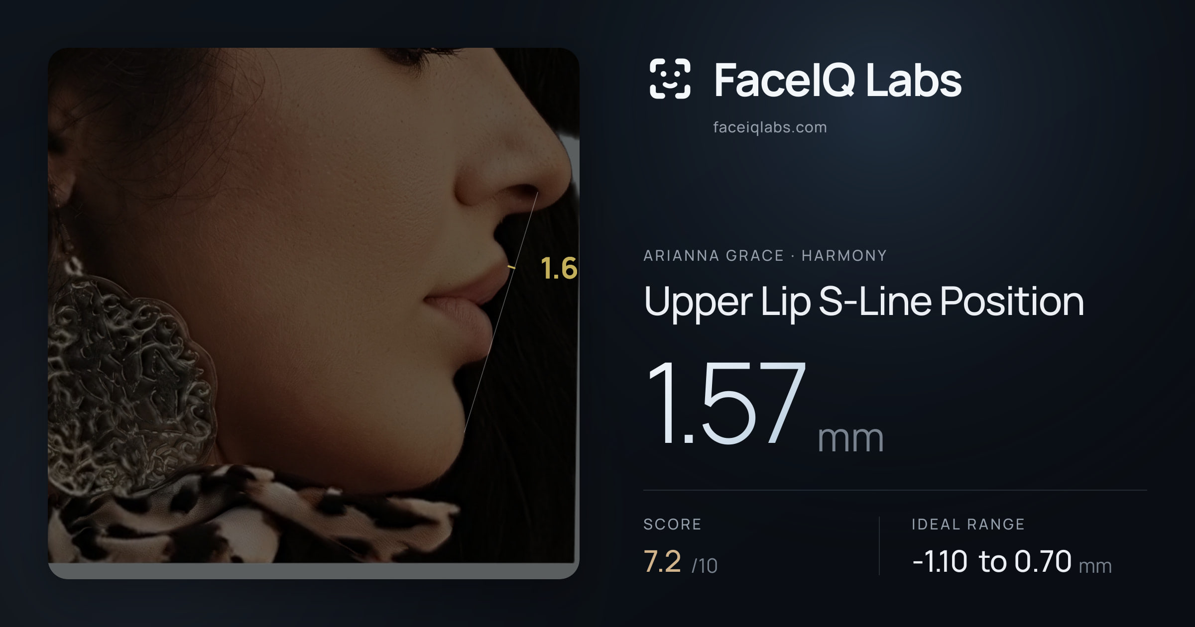 Arianna Grace Upper Lip S-Line Position: 1.57mm, drawn on the photo