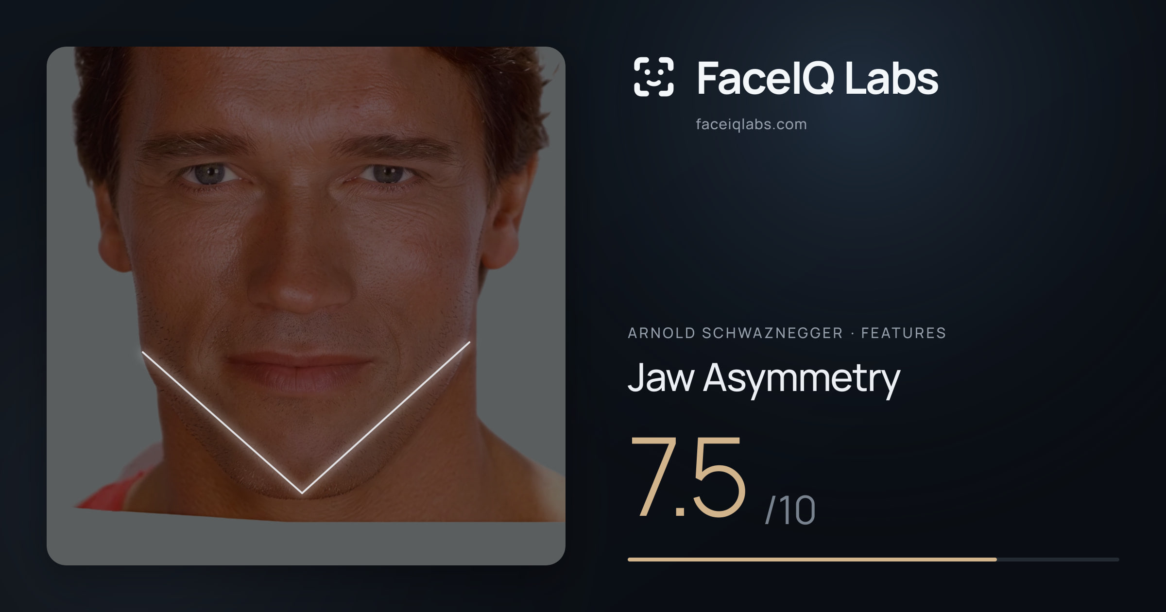 Arnold Schwaznegger Jaw Asymmetry: 7.5/10, drawn on the photo