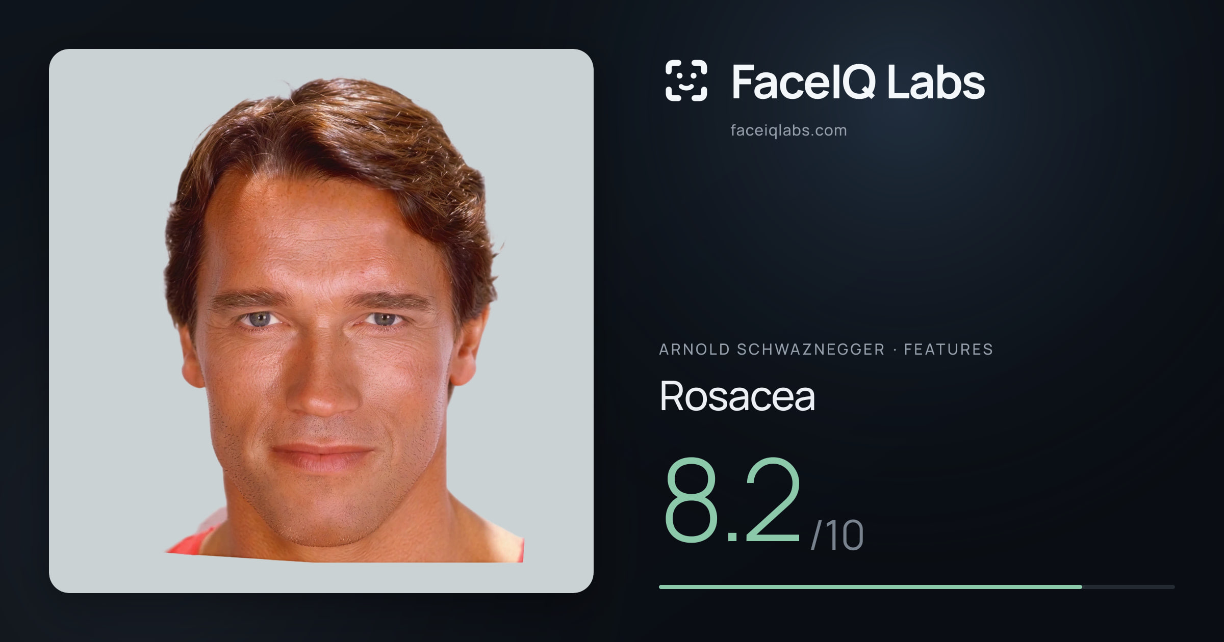 Arnold Schwaznegger Rosacea: 8.2/10, drawn on the photo