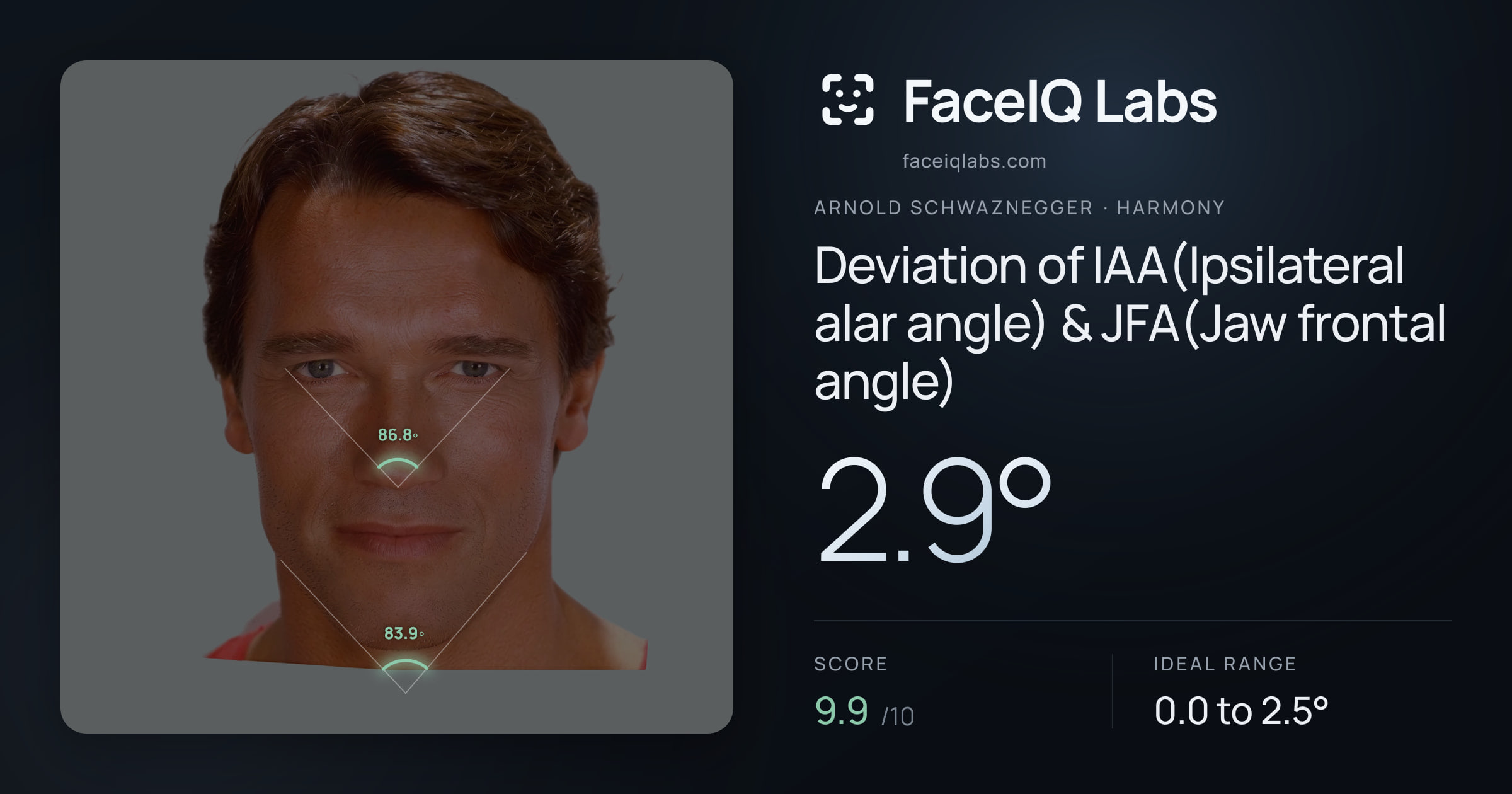 Arnold Schwaznegger Deviation of IAA(Ipsilateral alar angle) & JFA(Jaw frontal angle): 2.9°, drawn on the photo