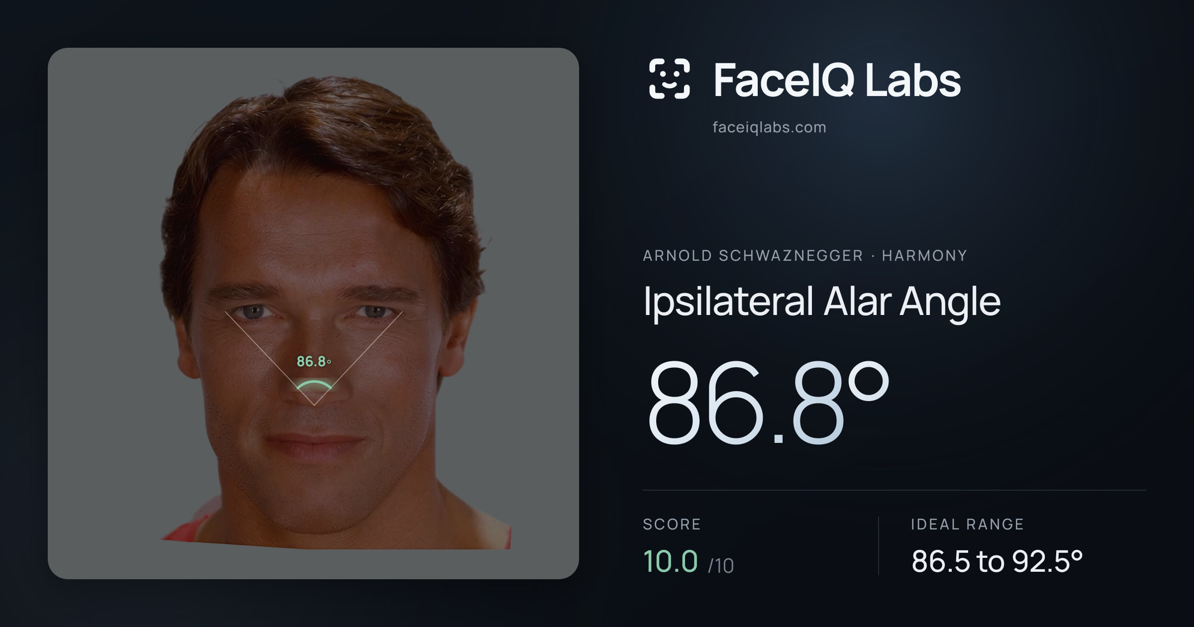Arnold Schwaznegger Ipsilateral Alar Angle: 86.8°, drawn on the photo