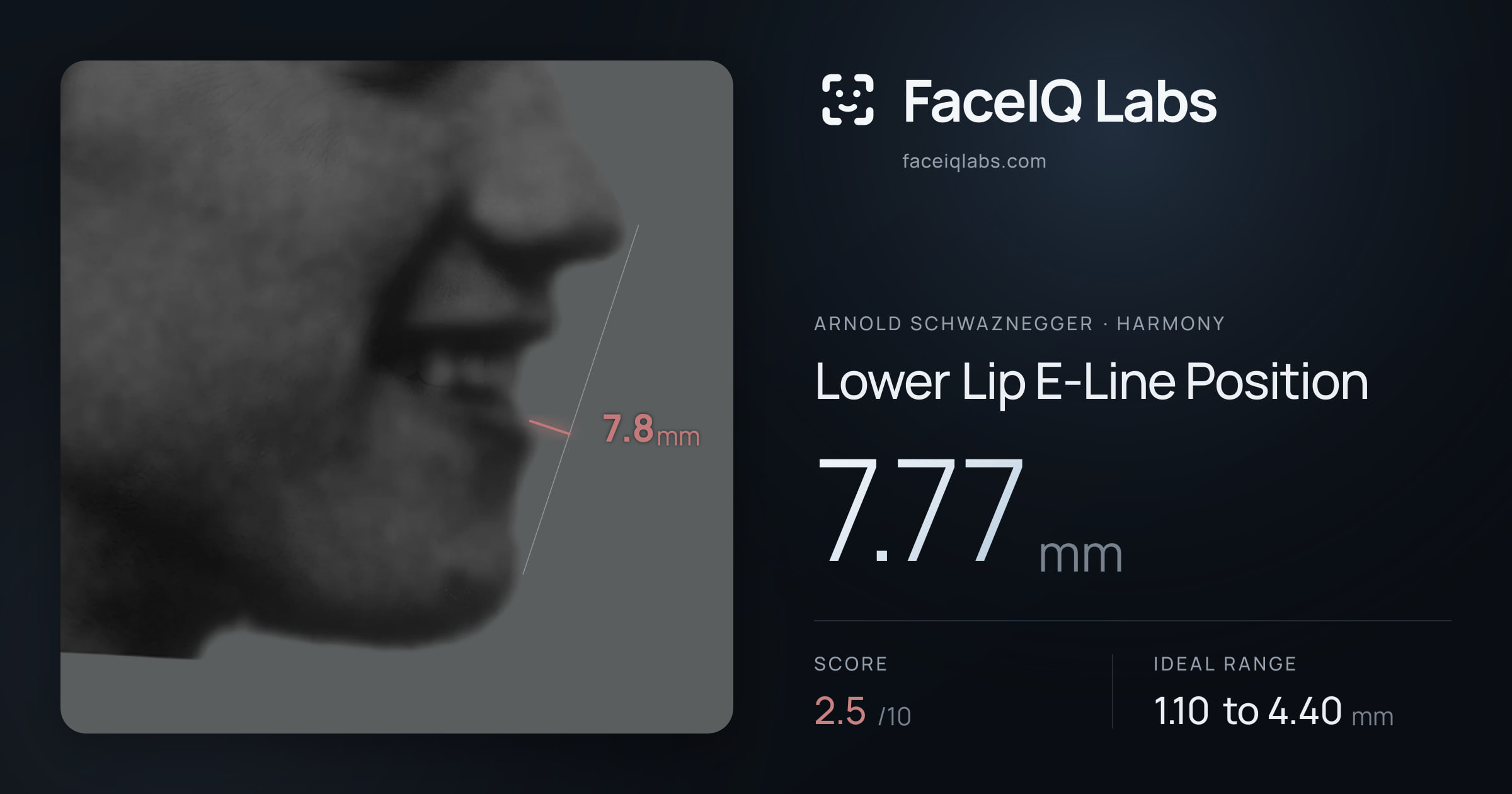 Arnold Schwaznegger Lower Lip E-Line Position: 7.77mm, drawn on the photo