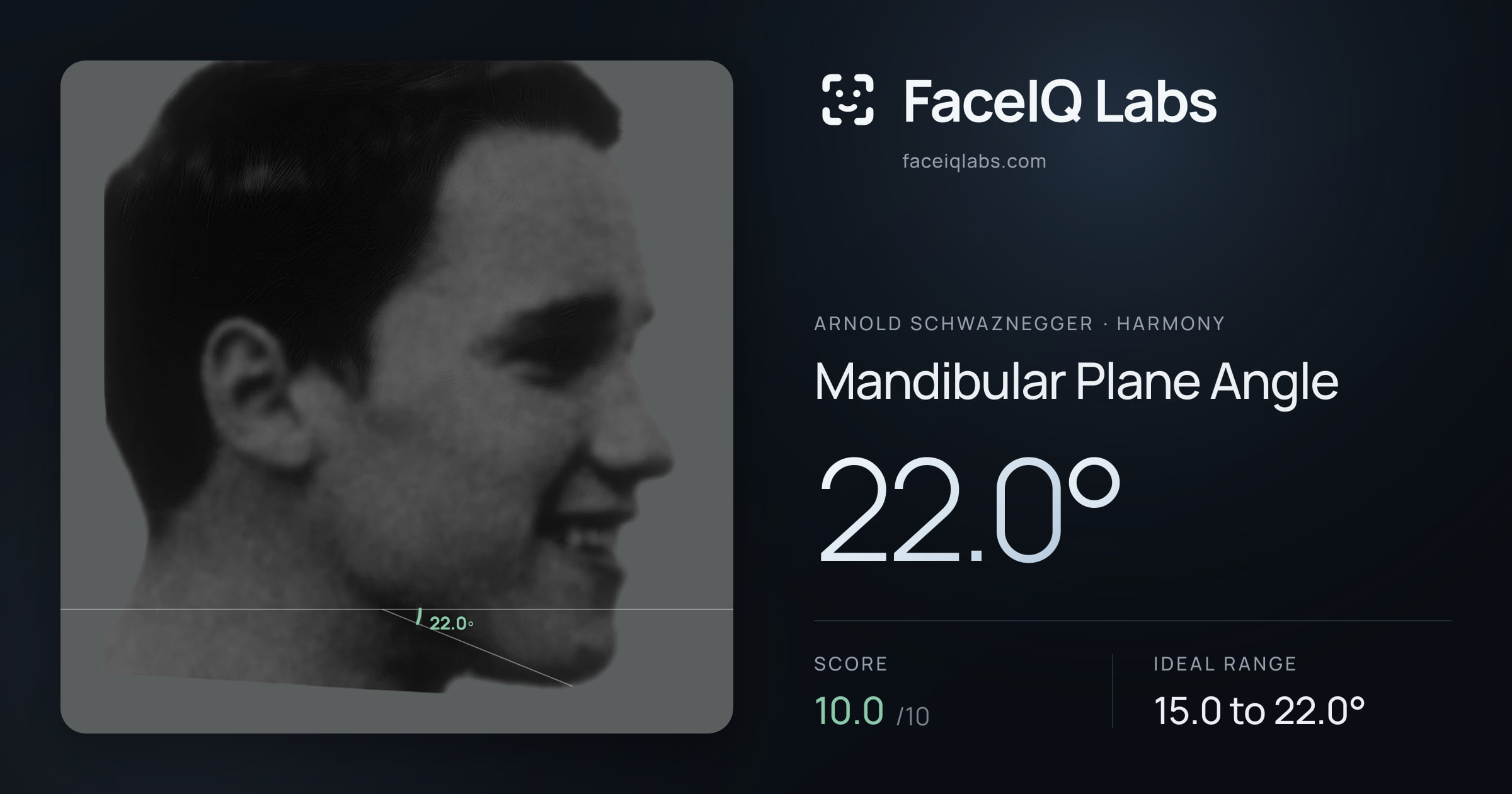 Arnold Schwaznegger Mandibular Plane Angle: 22.0°, drawn on the photo