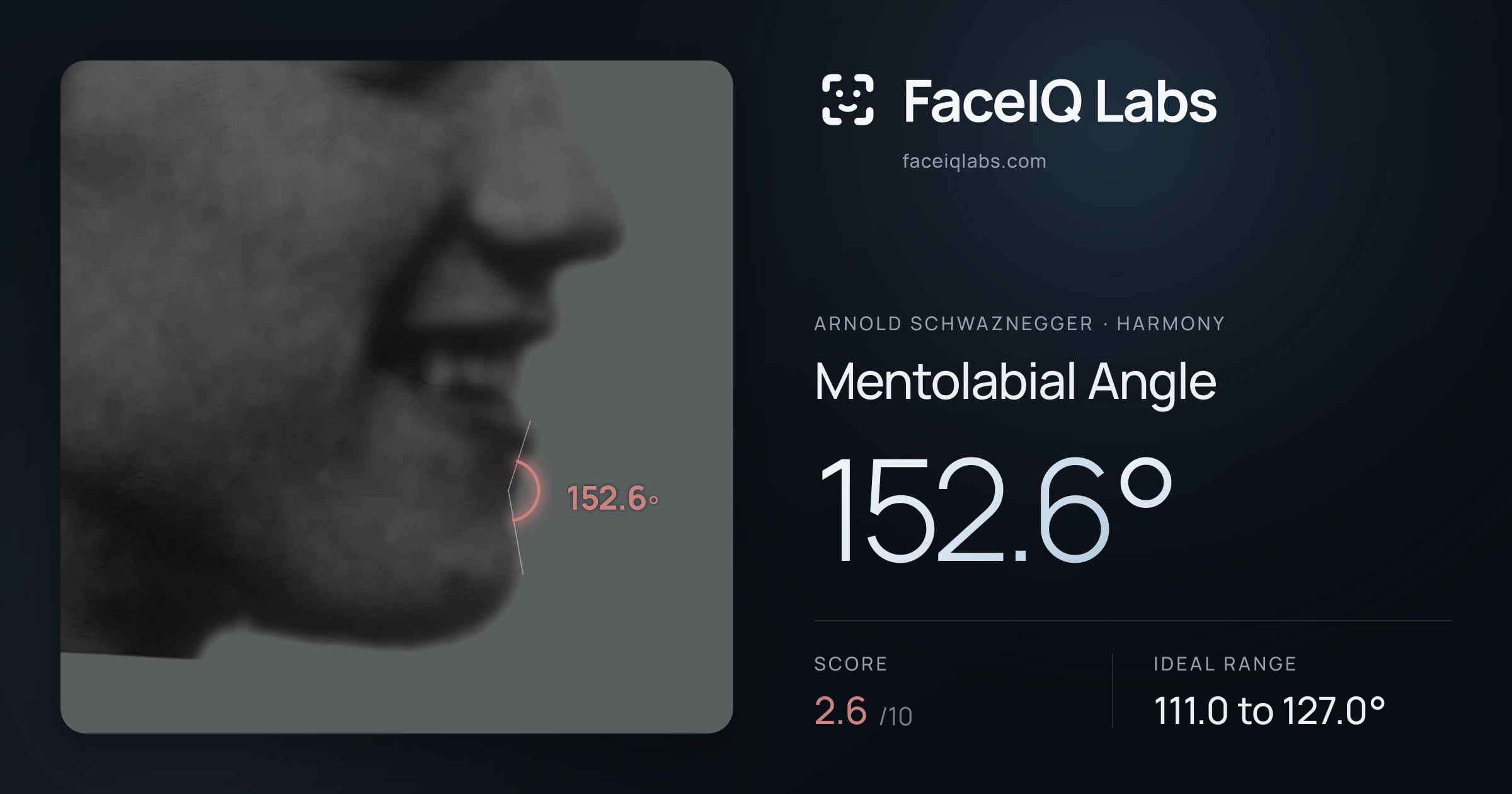 Arnold Schwaznegger Mentolabial Angle: 152.6°, drawn on the photo