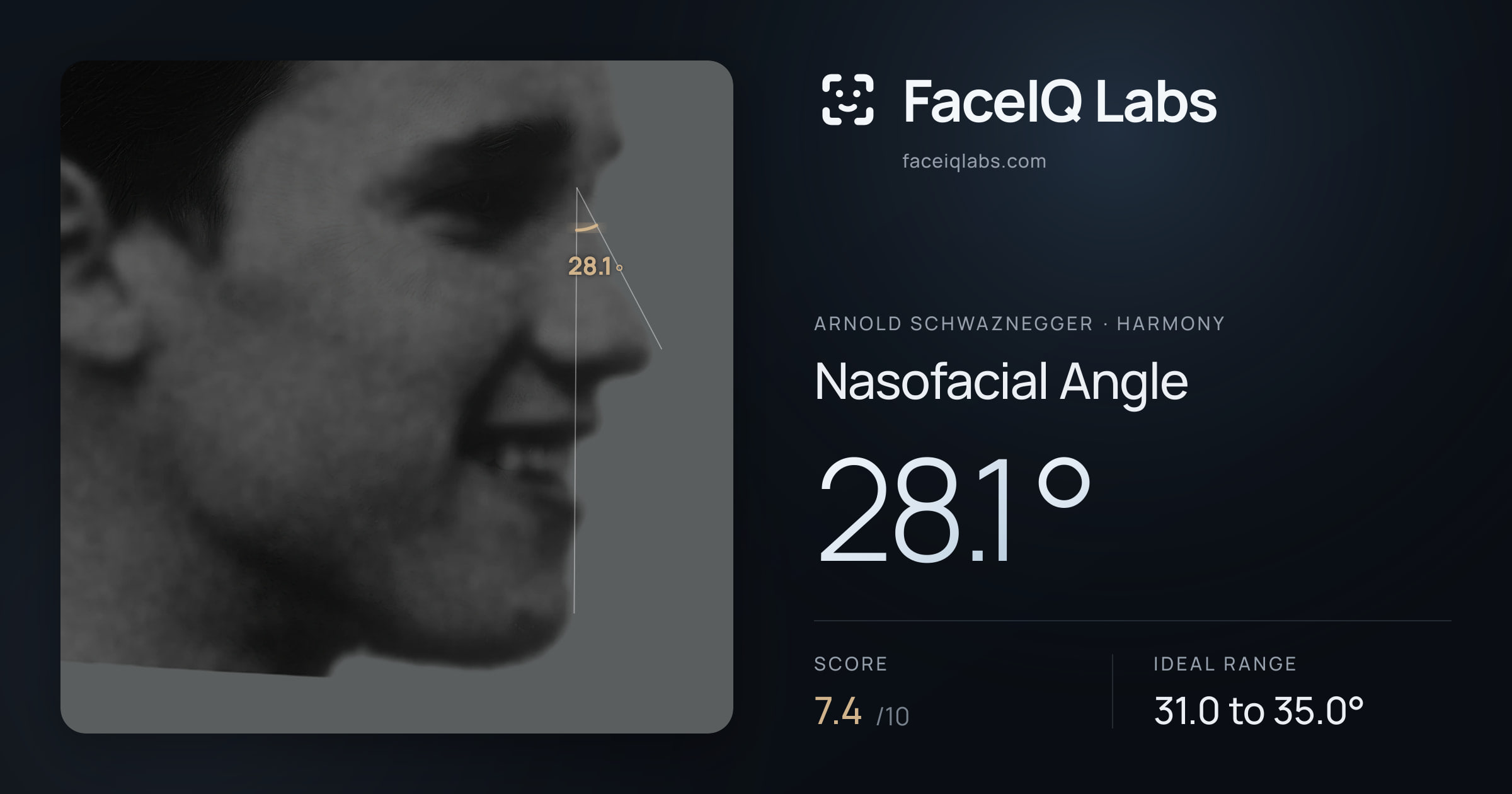 Arnold Schwaznegger Nasofacial Angle: 28.1°, drawn on the photo