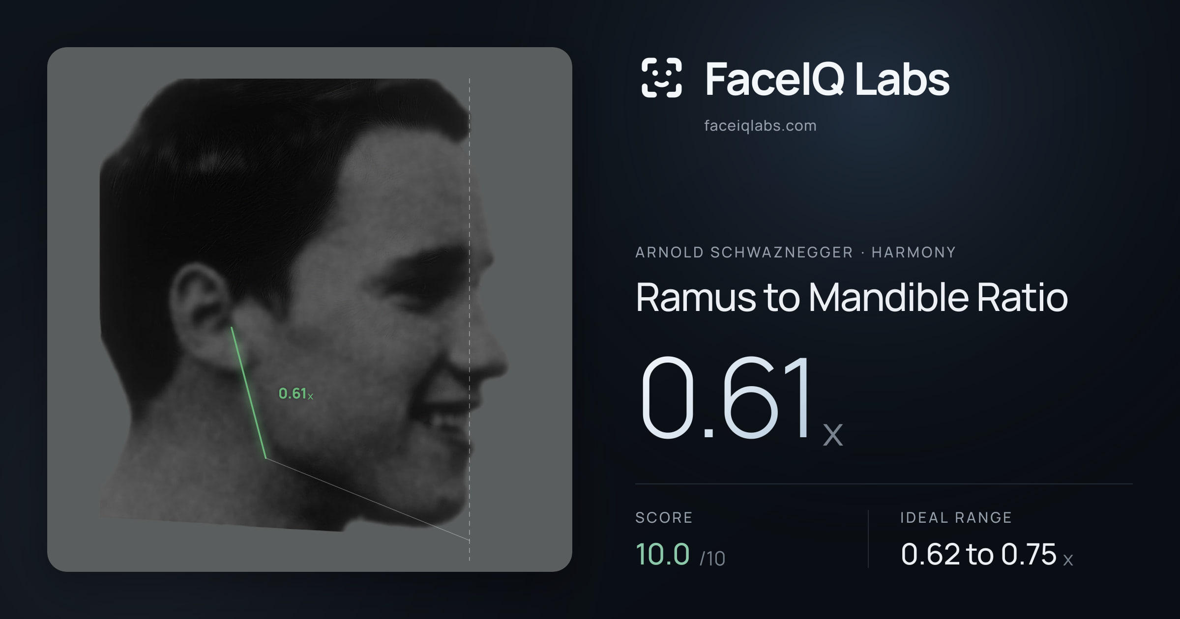 Arnold Schwaznegger Ramus to Mandible Ratio: 0.61x, drawn on the photo