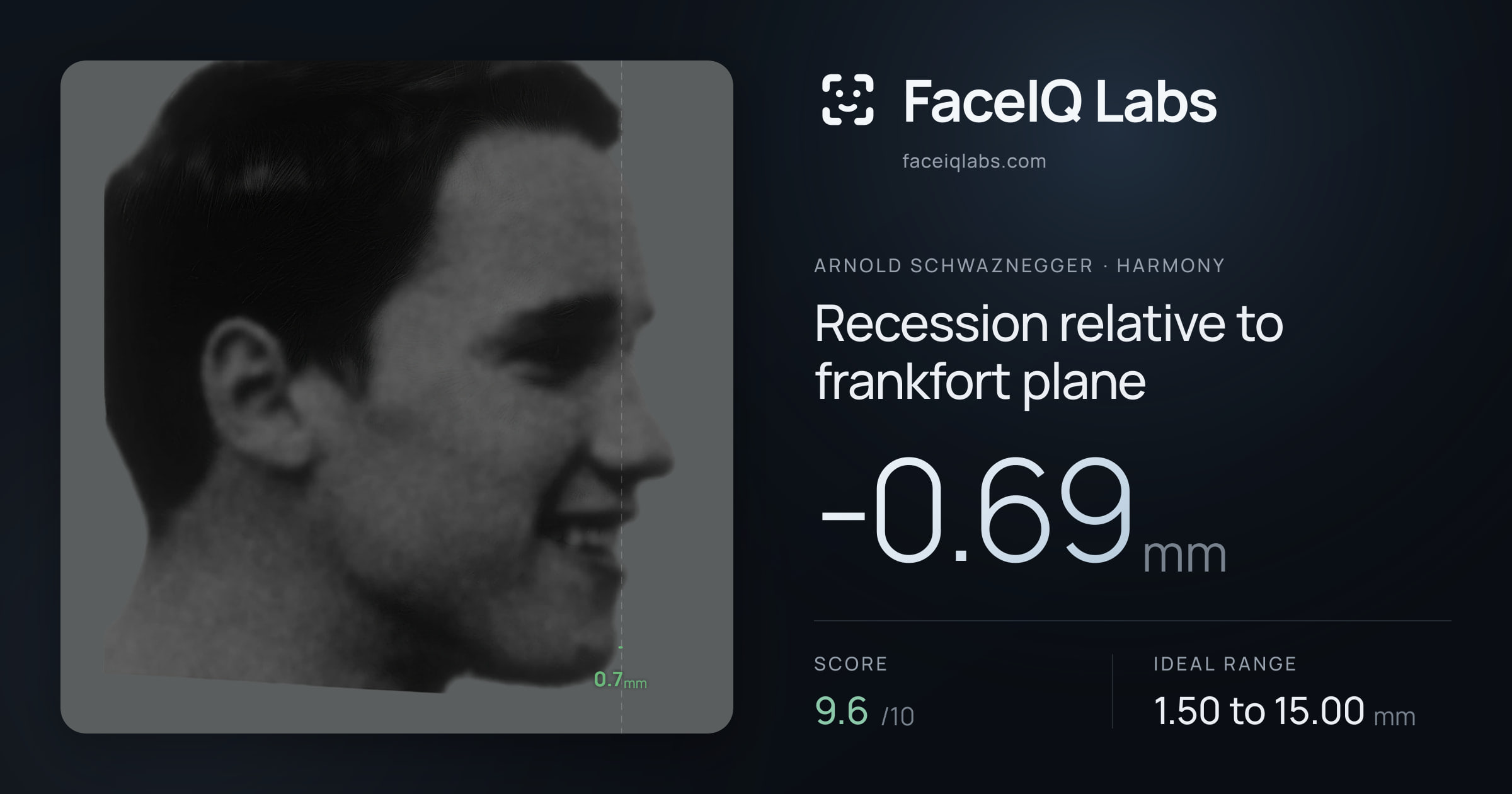 Arnold Schwaznegger Recession relative to frankfort plane: -0.69mm, drawn on the photo