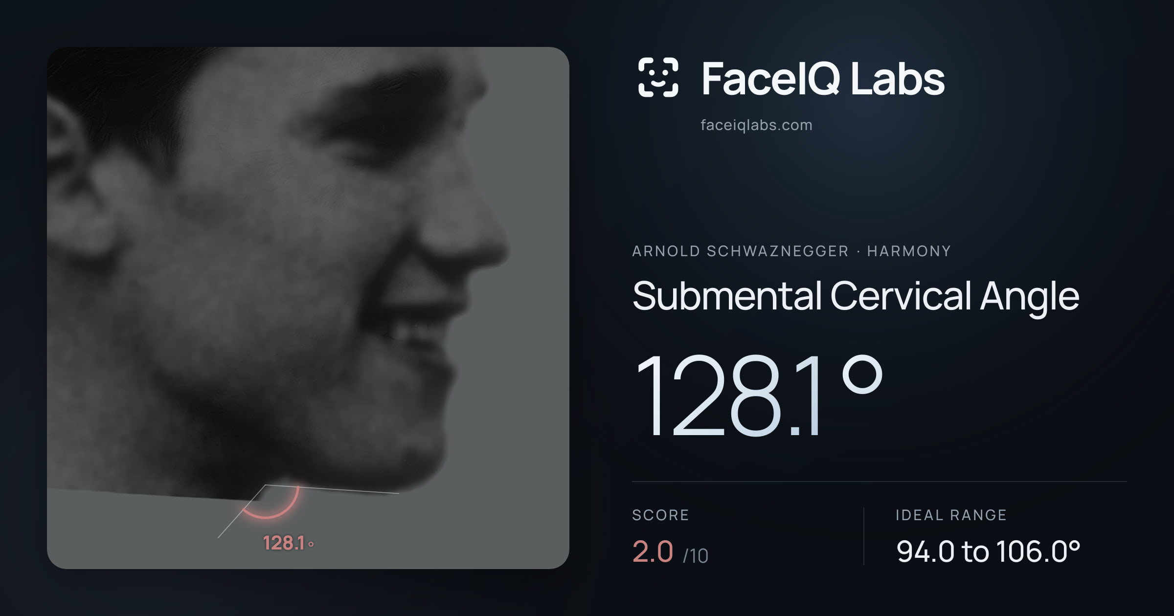 Arnold Schwaznegger Submental Cervical Angle: 128.1°, drawn on the photo