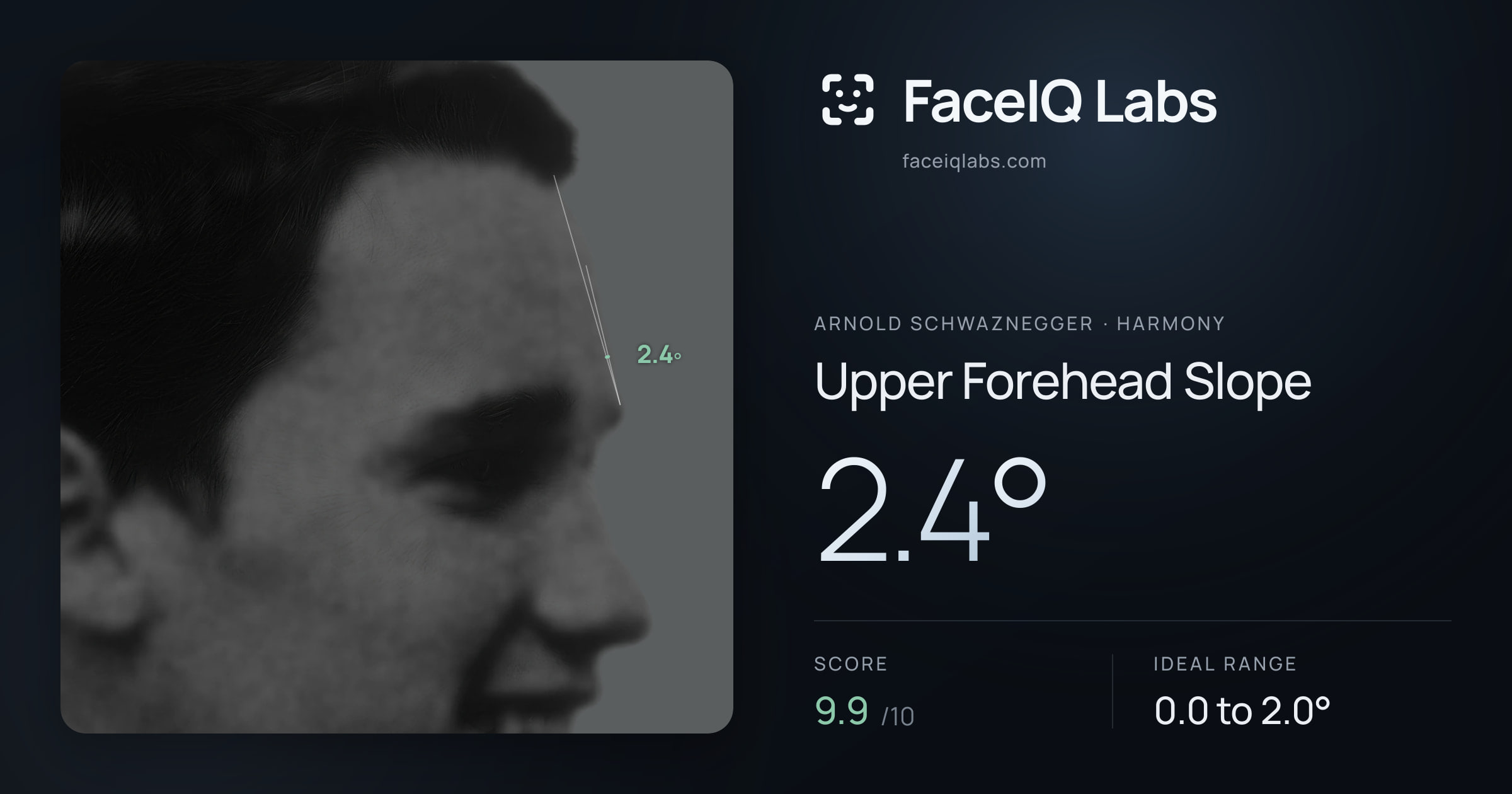 Arnold Schwaznegger Upper Forehead Slope: 2.4°, drawn on the photo