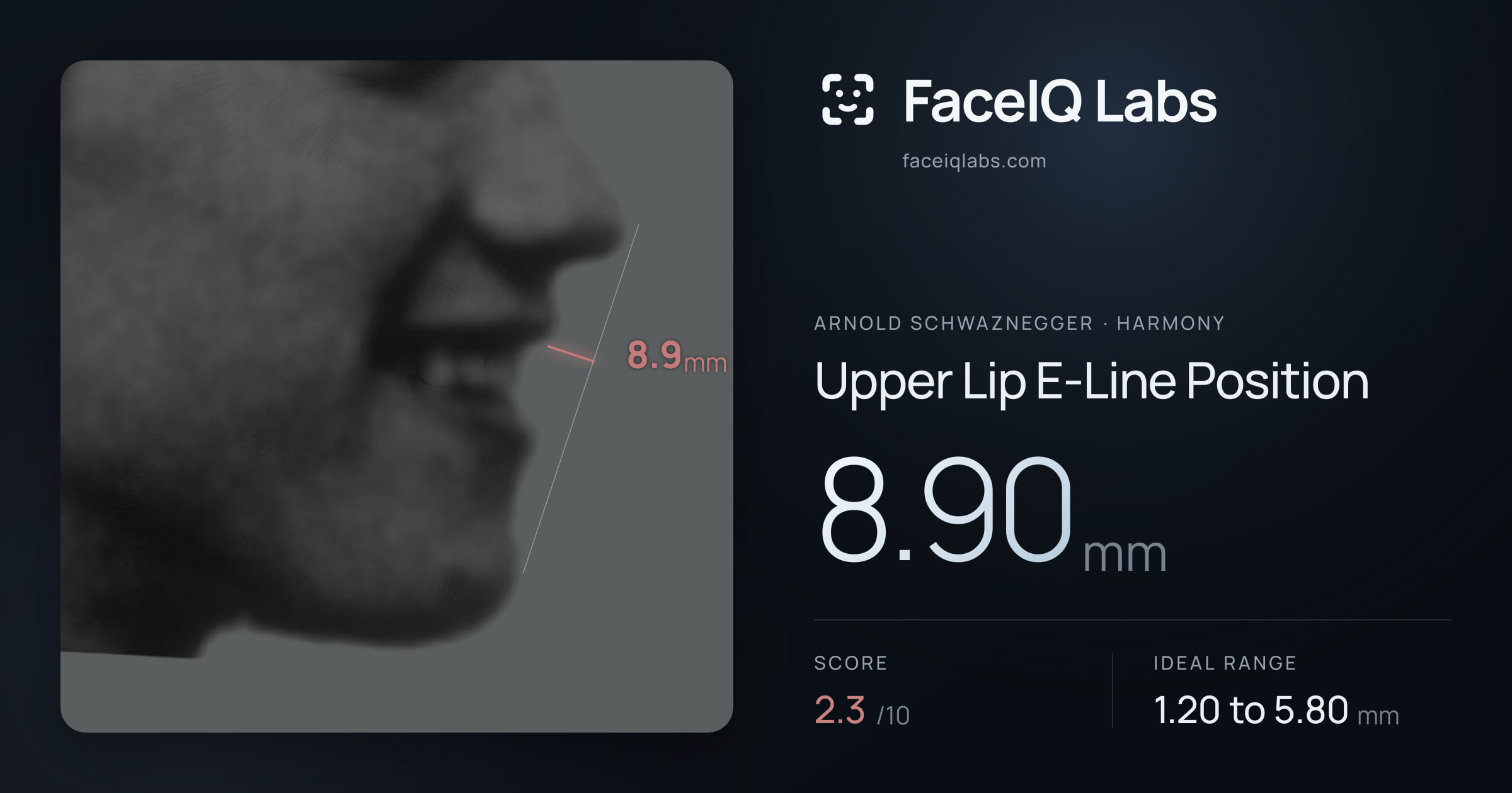 Arnold Schwaznegger Upper Lip E-Line Position: 8.90mm, drawn on the photo