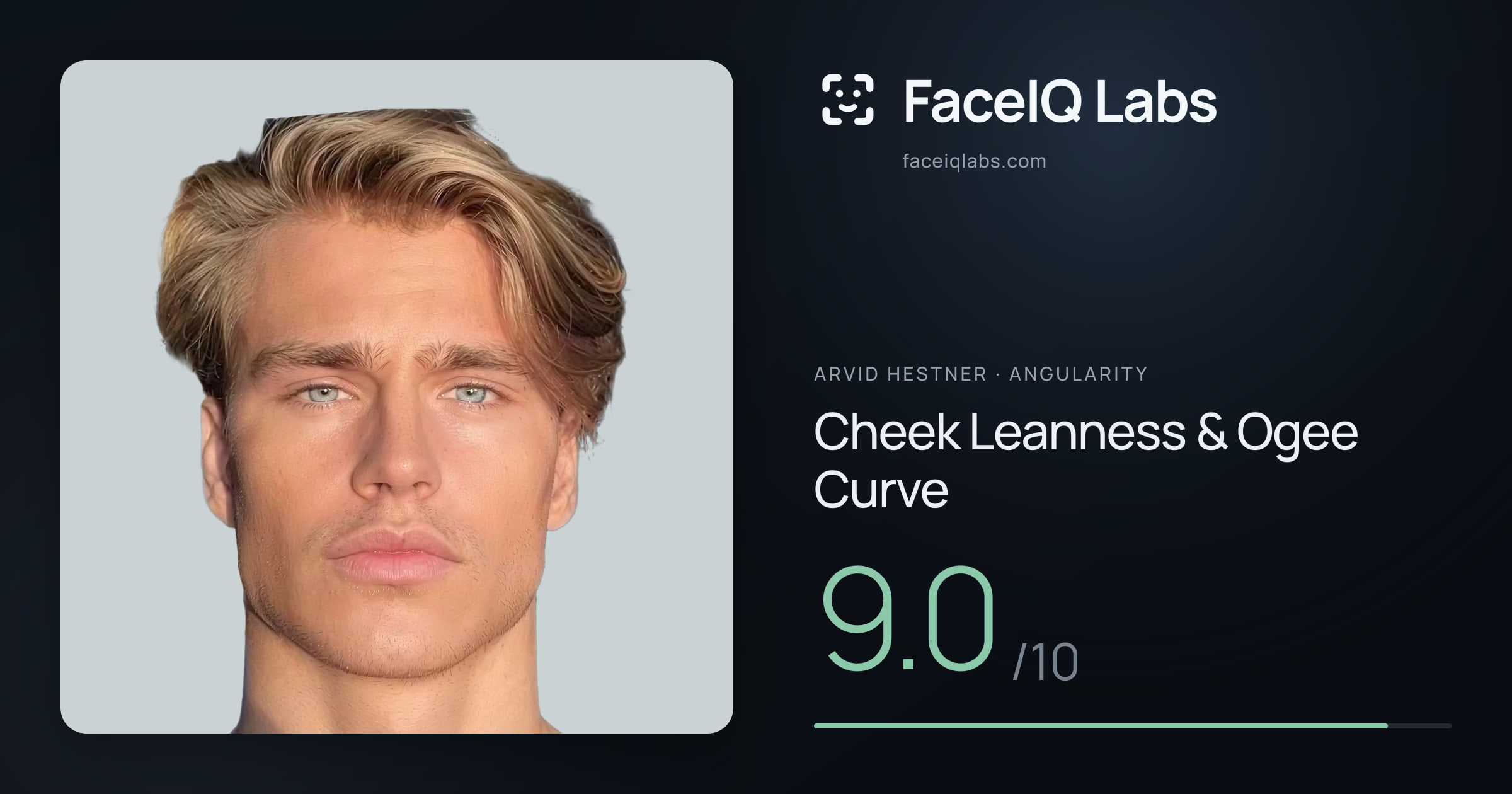 Arvid Hestner Cheek Leanness & Ogee Curve: 9.0/10, drawn on the photo
