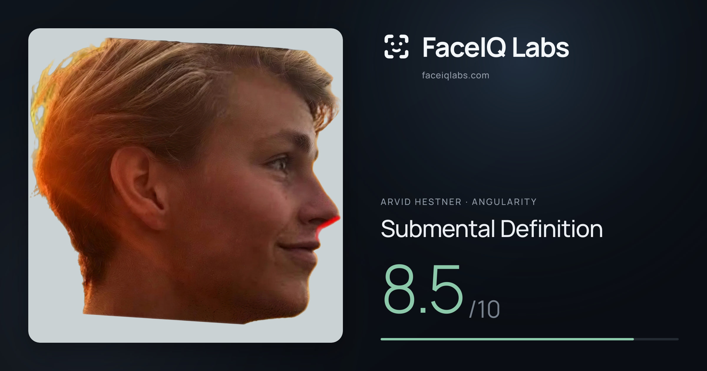 Arvid Hestner Submental Definition: 8.5/10, drawn on the photo