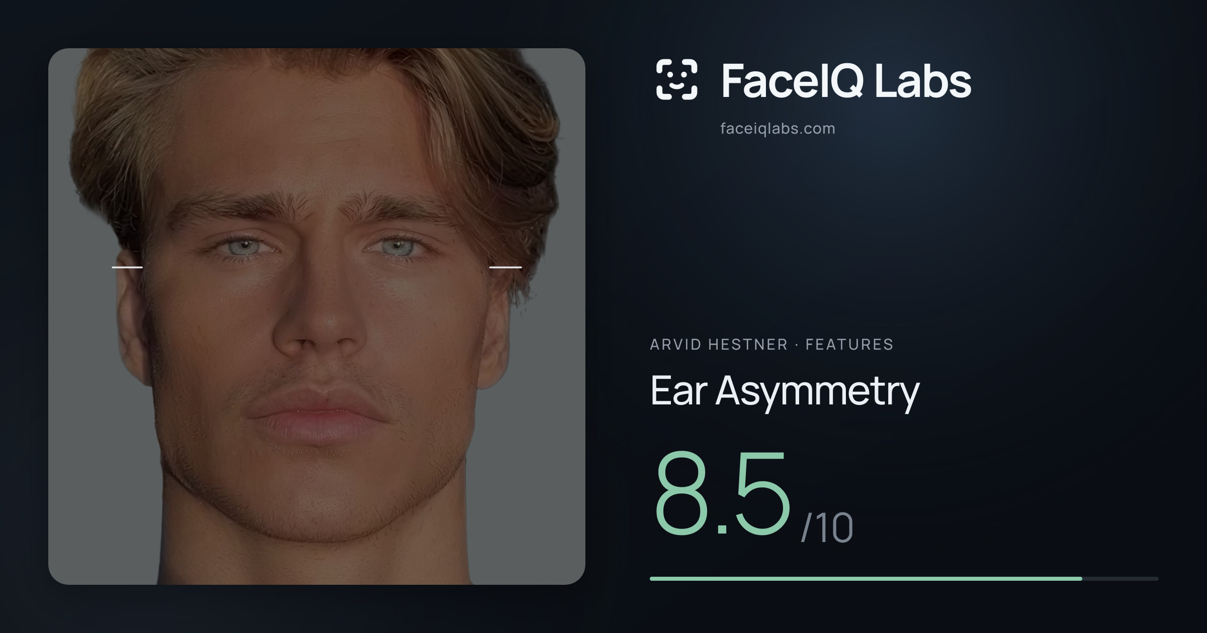 Arvid Hestner Ear Asymmetry: 8.5/10, drawn on the photo