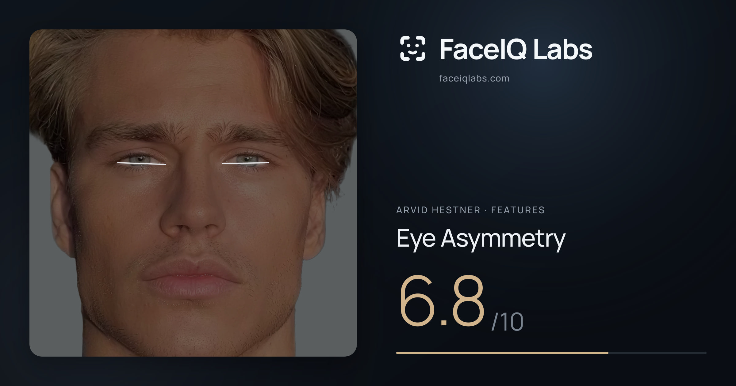 Arvid Hestner Eye Asymmetry: 6.8/10, drawn on the photo