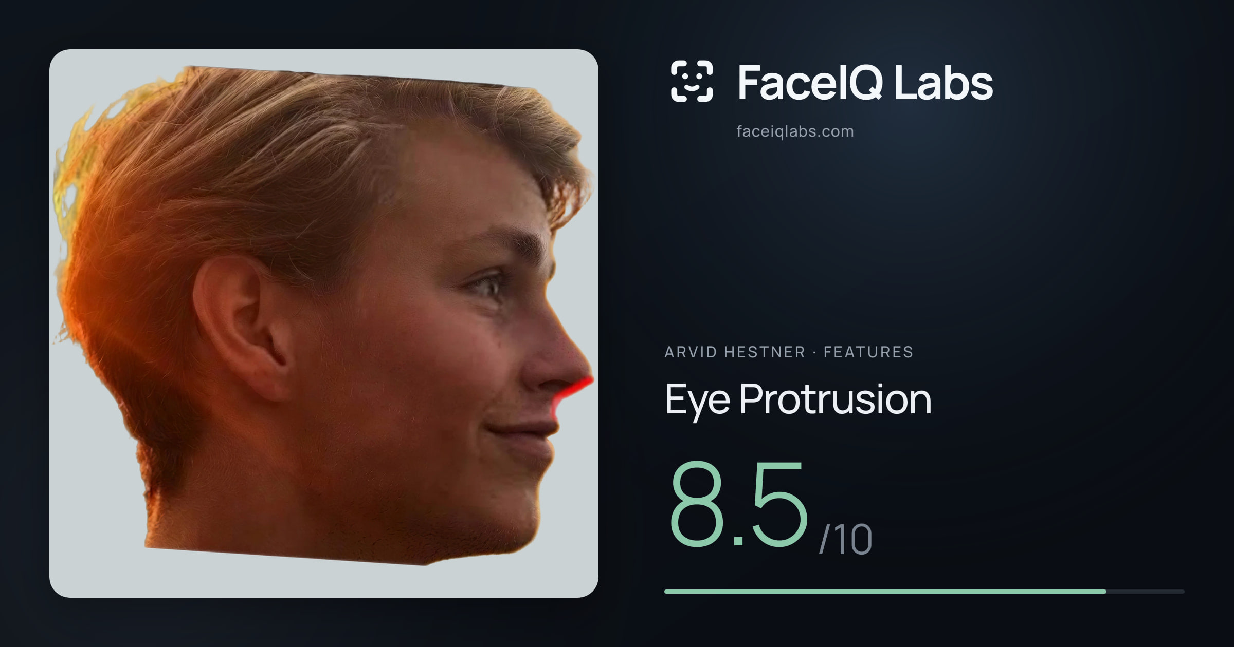 Arvid Hestner Eye Protrusion: 8.5/10, drawn on the photo