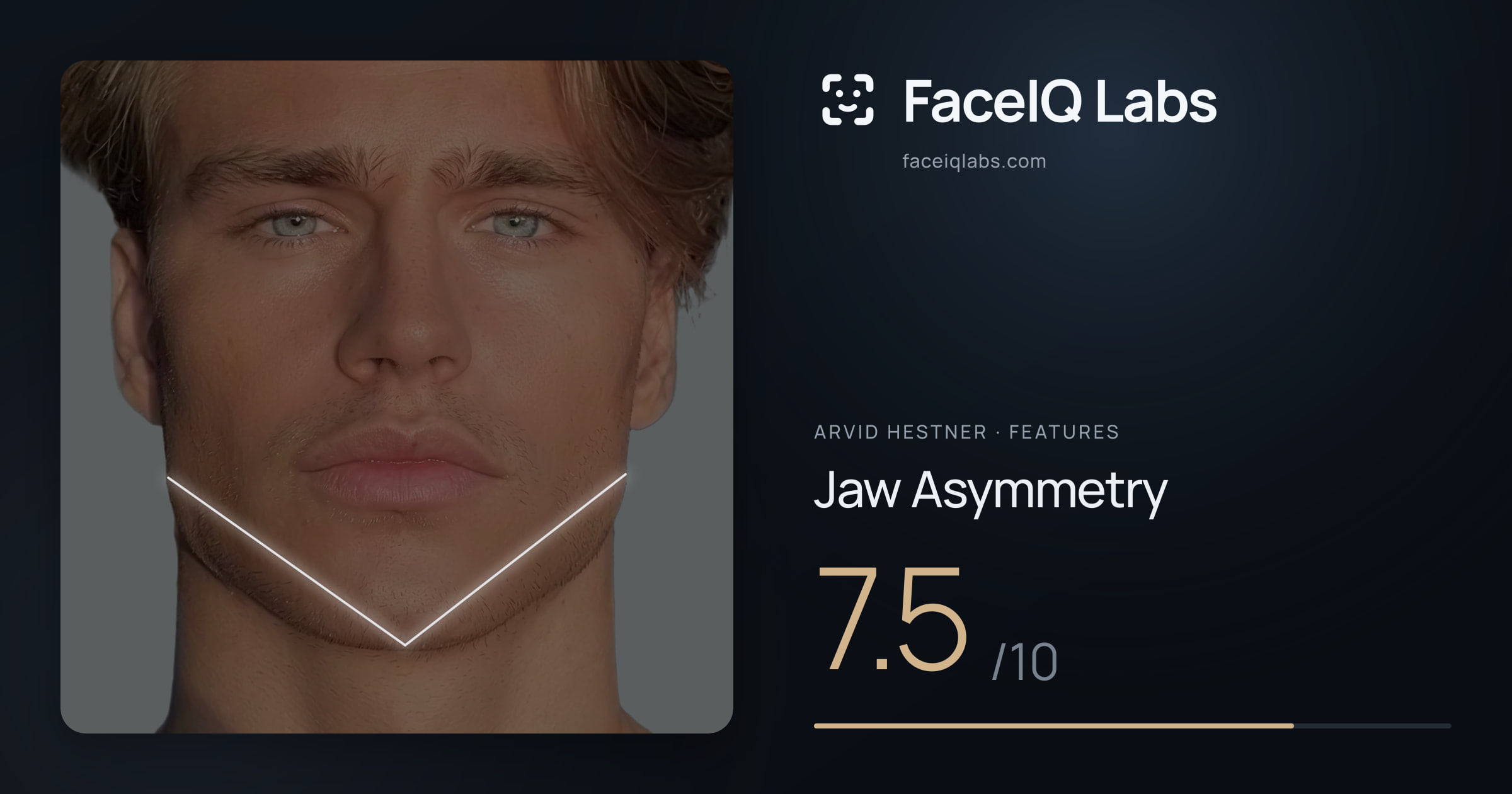 Arvid Hestner Jaw Asymmetry: 7.5/10, drawn on the photo