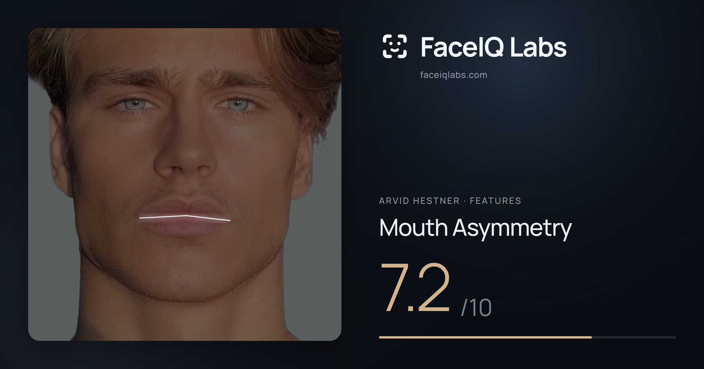 Arvid Hestner Mouth Asymmetry: 7.2/10, drawn on the photo