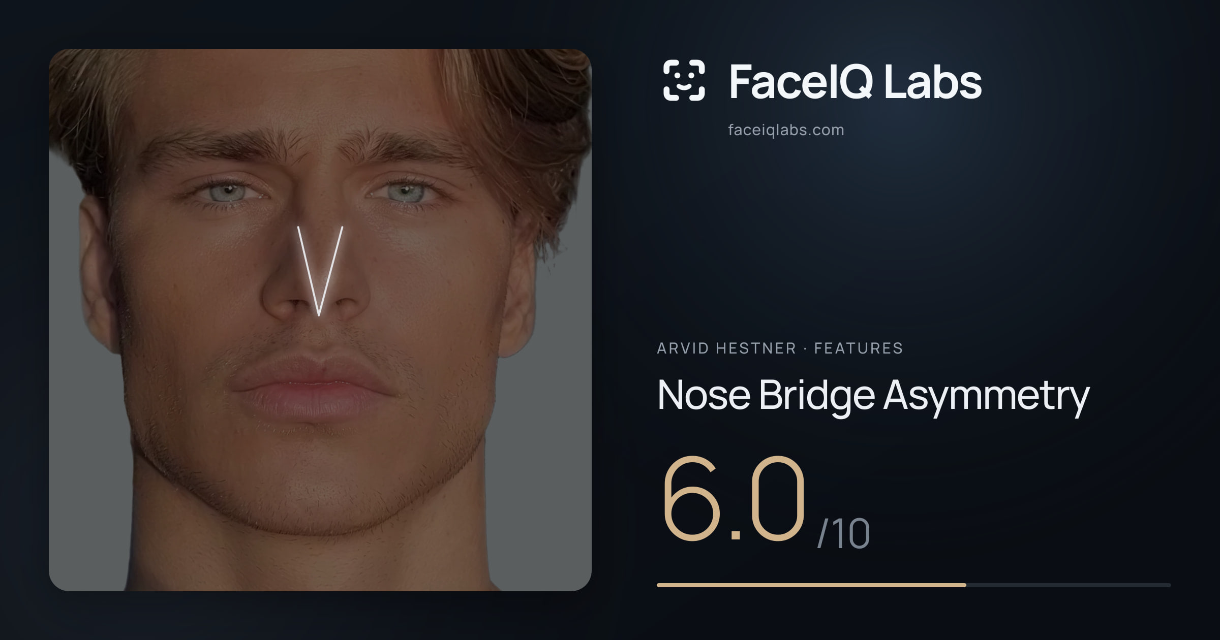 Arvid Hestner Nose Bridge Asymmetry: 6.0/10, drawn on the photo