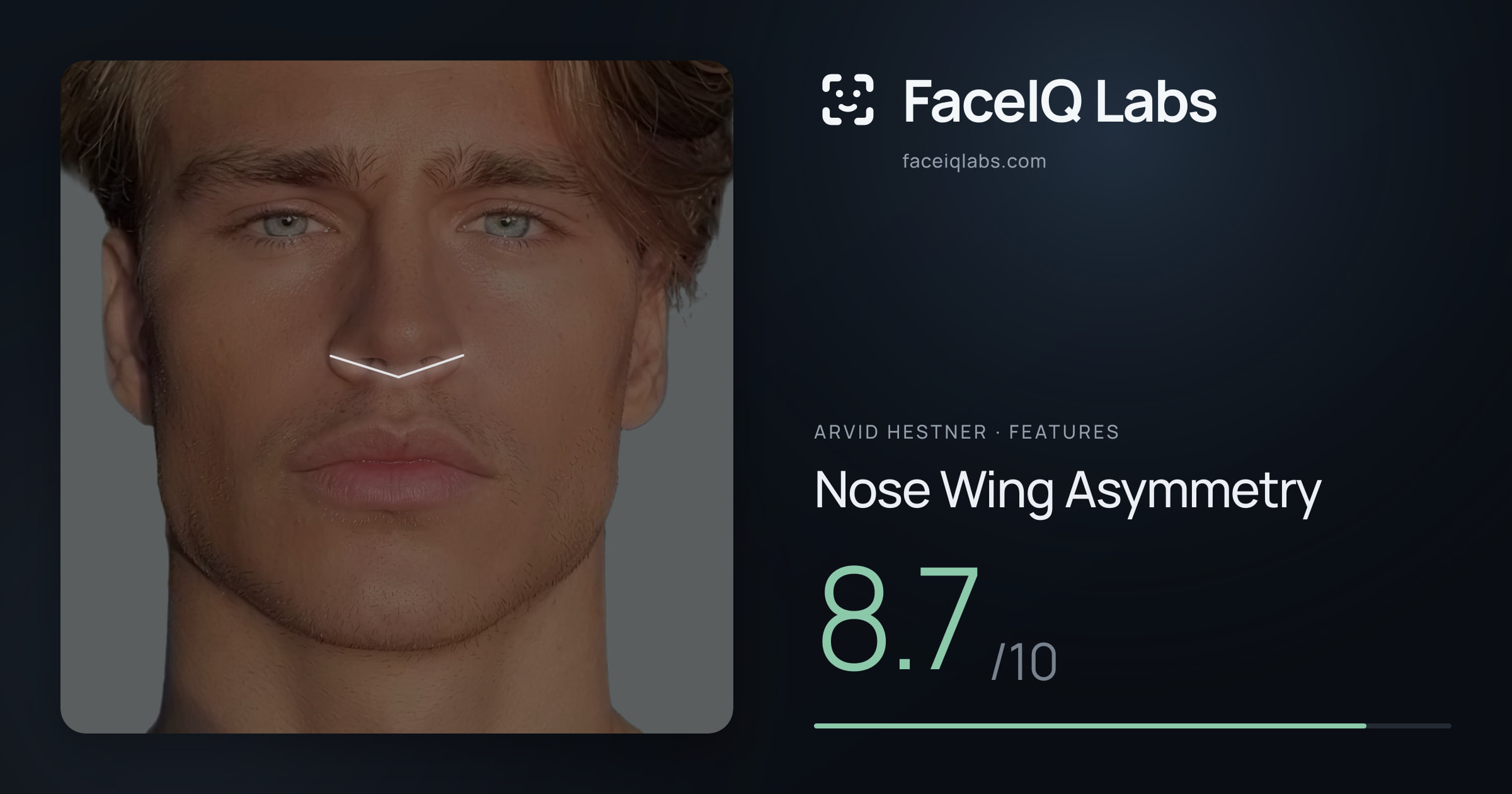 Arvid Hestner Nose Wing Asymmetry: 8.7/10, drawn on the photo