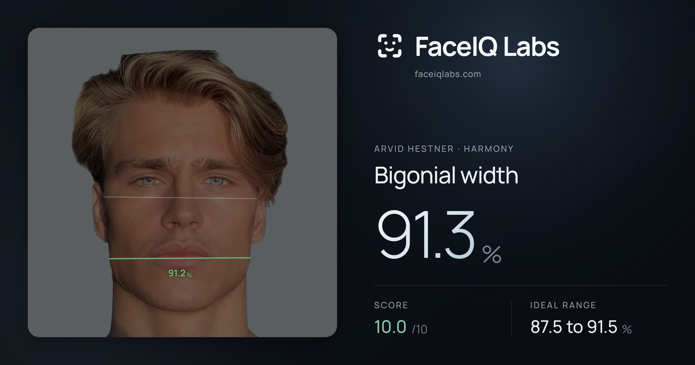 Arvid Hestner Bigonial width: 91.3%, drawn on the photo