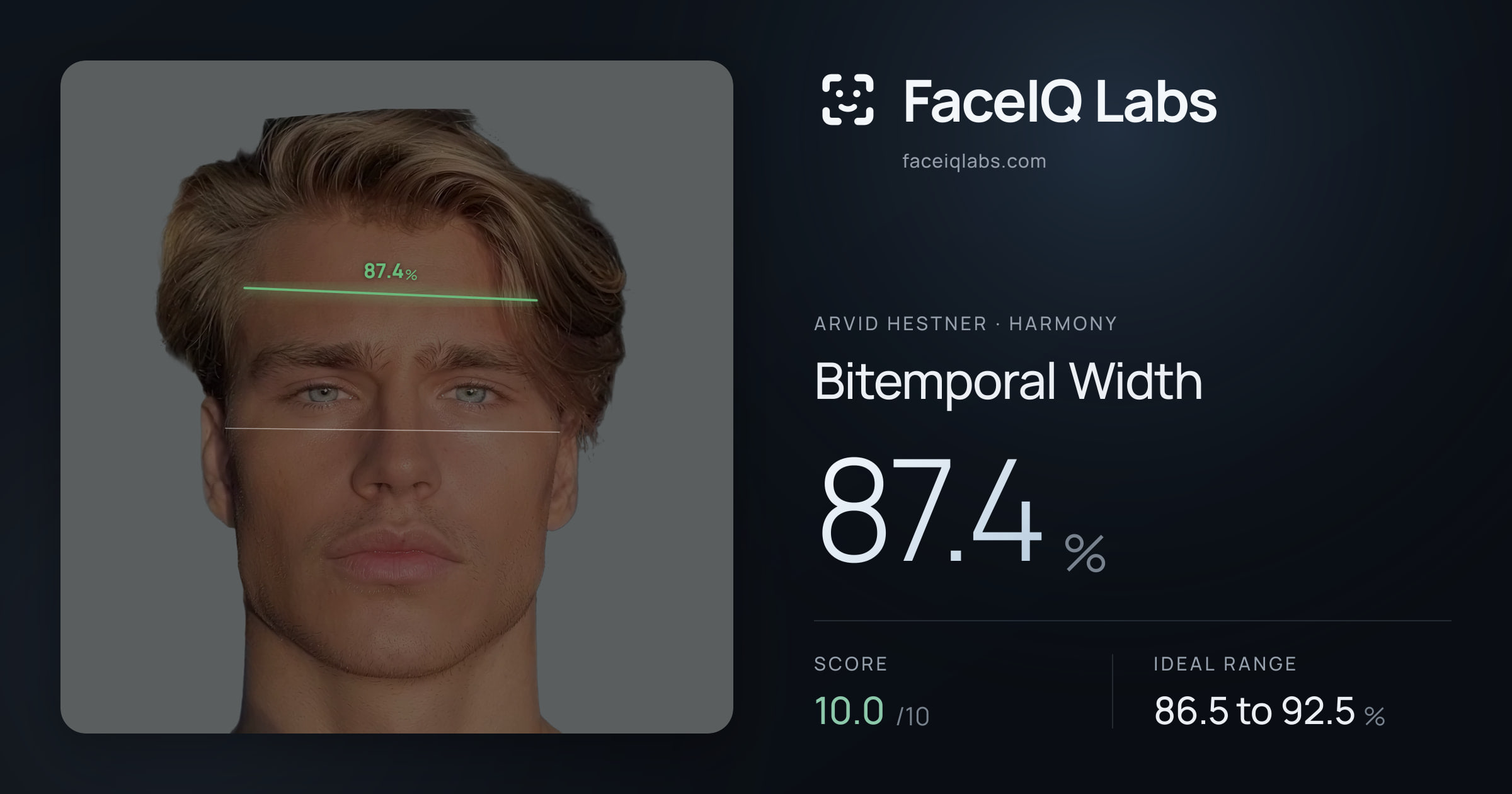 Arvid Hestner Bitemporal Width: 87.4%, drawn on the photo