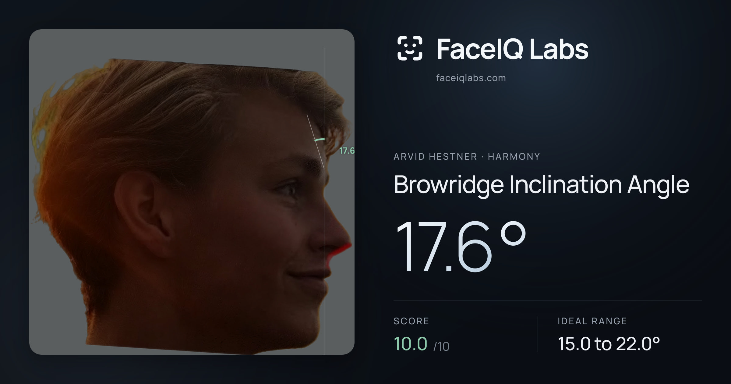 Arvid Hestner Browridge Inclination Angle: 17.6°, drawn on the photo