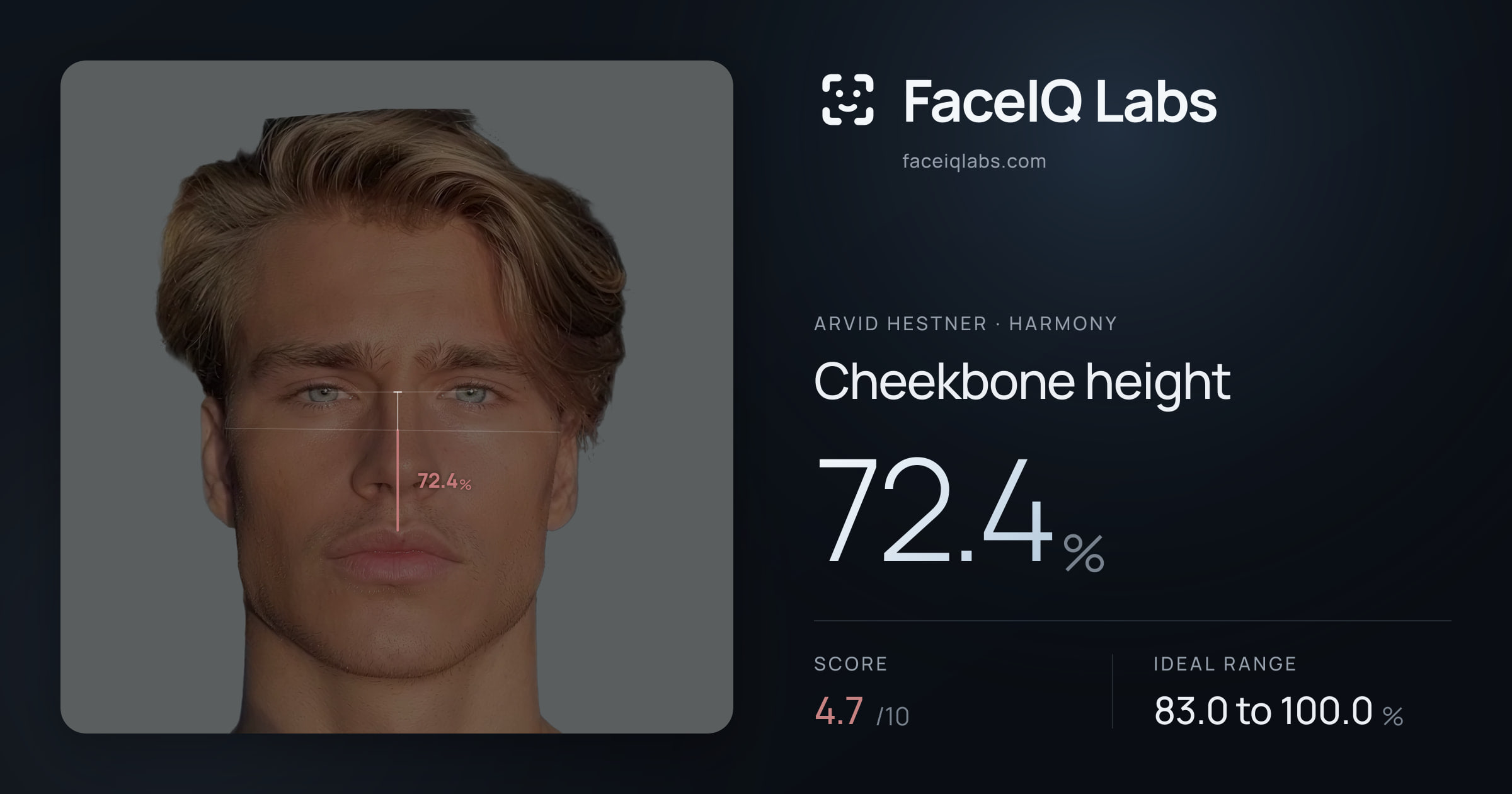 Arvid Hestner Cheekbone height: 72.4%, drawn on the photo