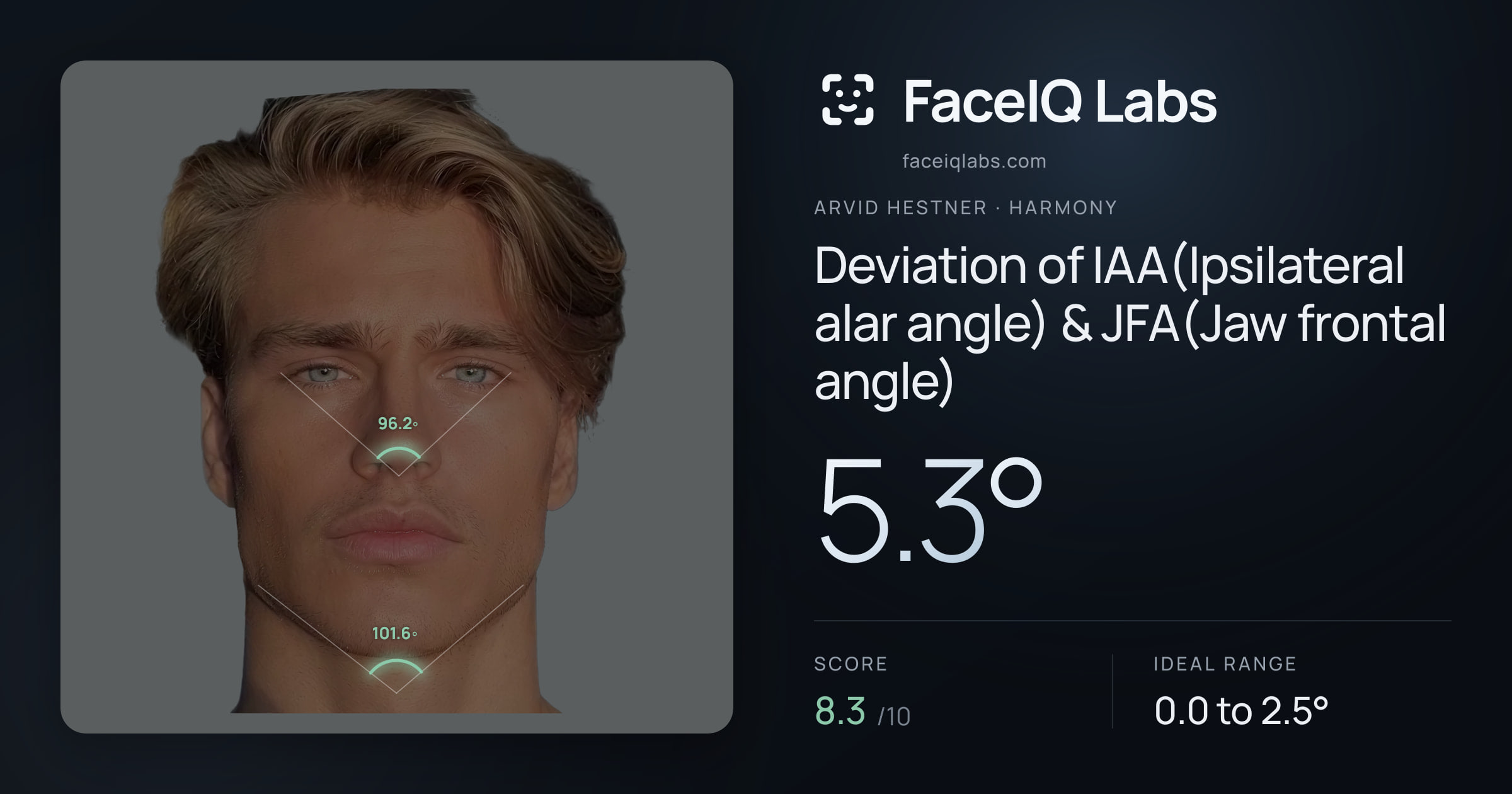 Arvid Hestner Deviation of IAA(Ipsilateral alar angle) & JFA(Jaw frontal angle): 5.3°, drawn on the photo