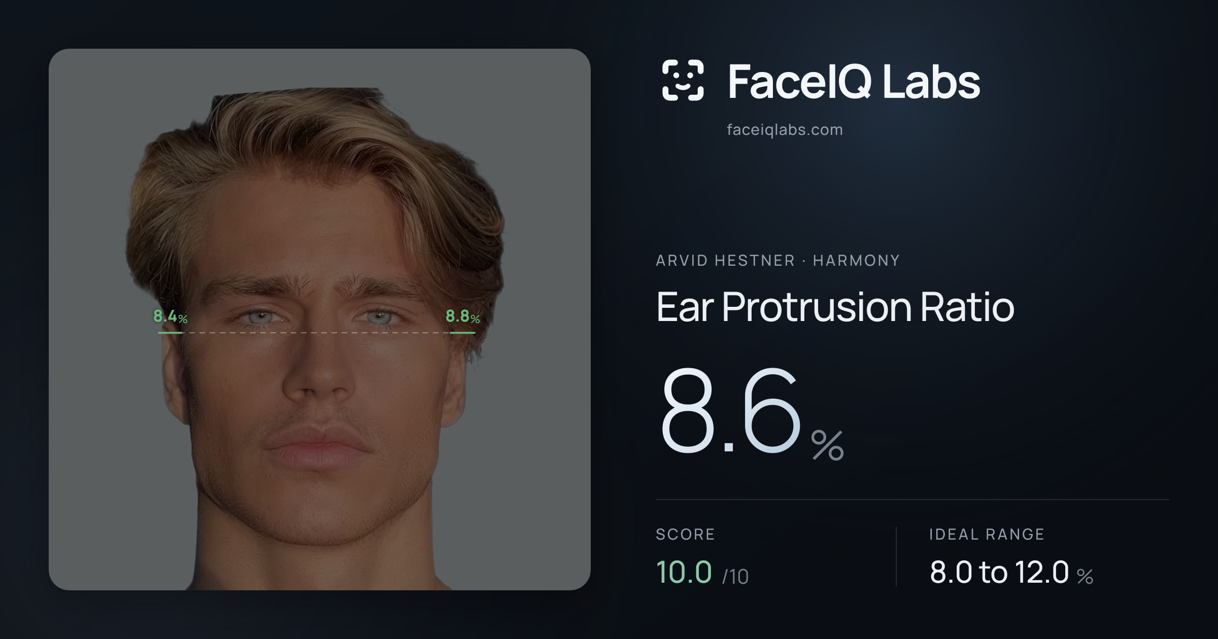 Arvid Hestner Ear Protrusion Ratio: 8.6%, drawn on the photo