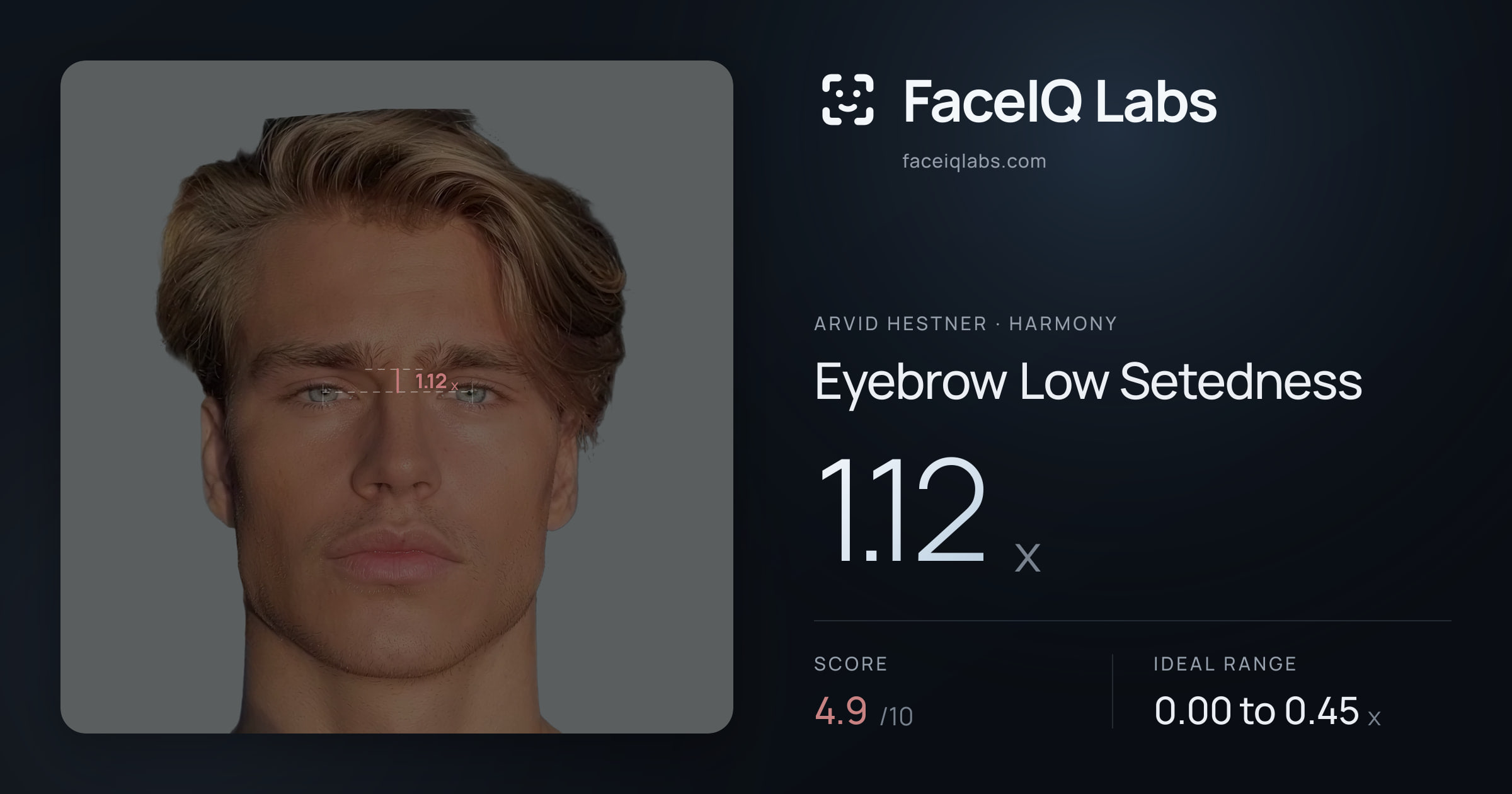 Arvid Hestner Eyebrow Low Setedness: 1.12x, drawn on the photo