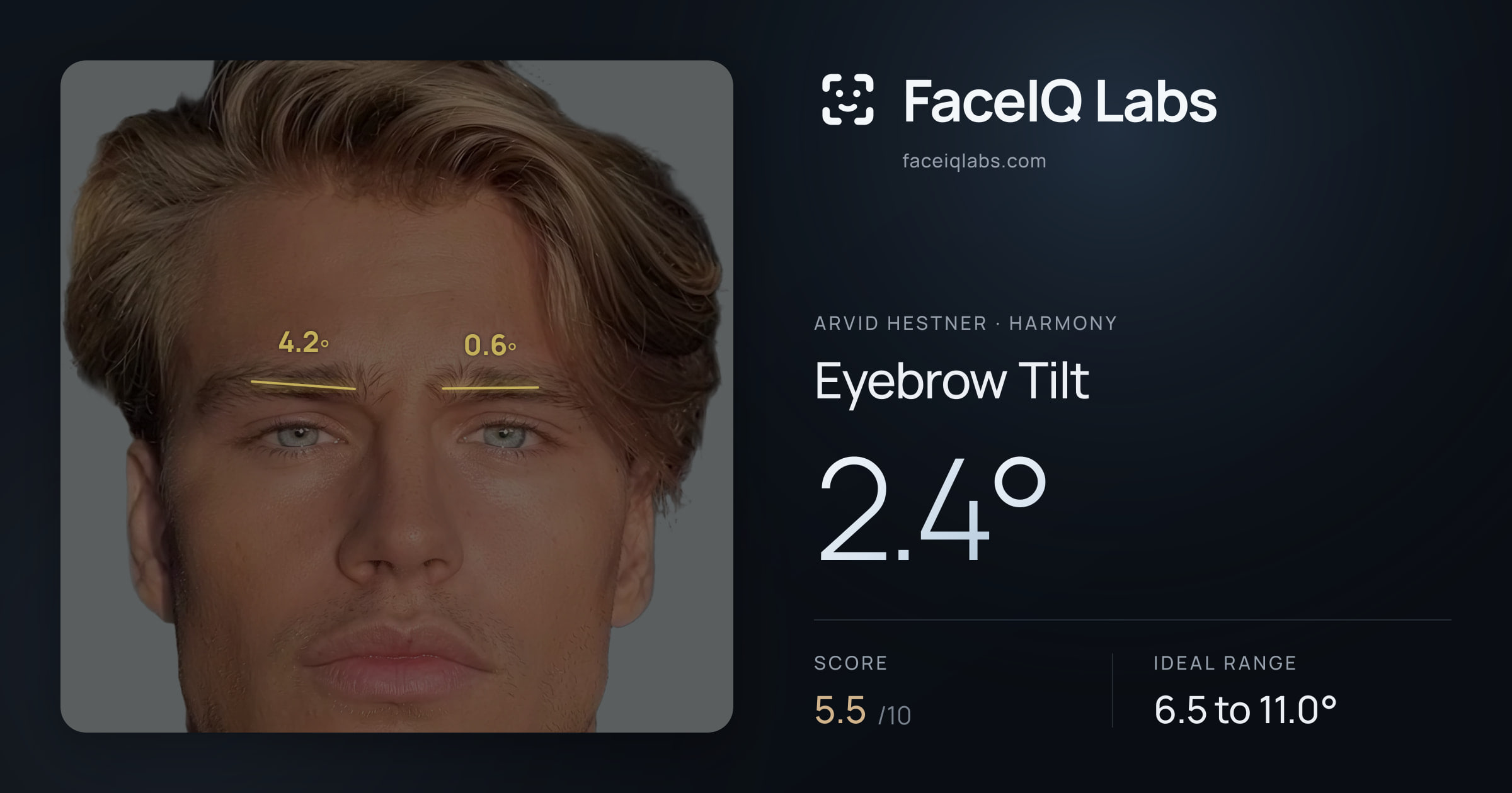 Arvid Hestner Eyebrow Tilt: 2.4°, drawn on the photo