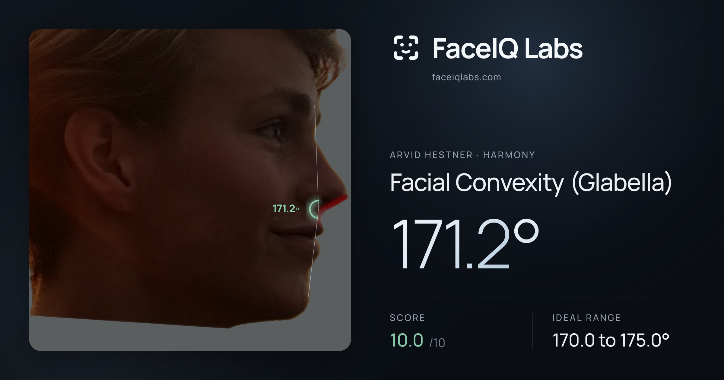 Arvid Hestner Facial Convexity (Glabella): 171.2°, drawn on the photo