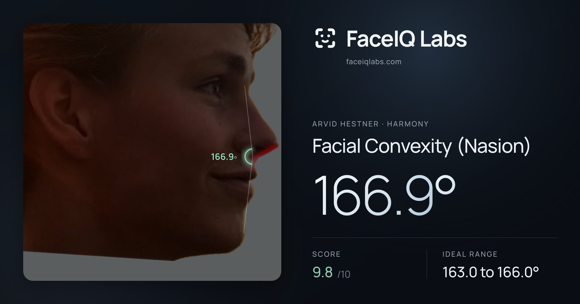 Arvid Hestner Facial Convexity (Nasion): 166.9°, drawn on the photo