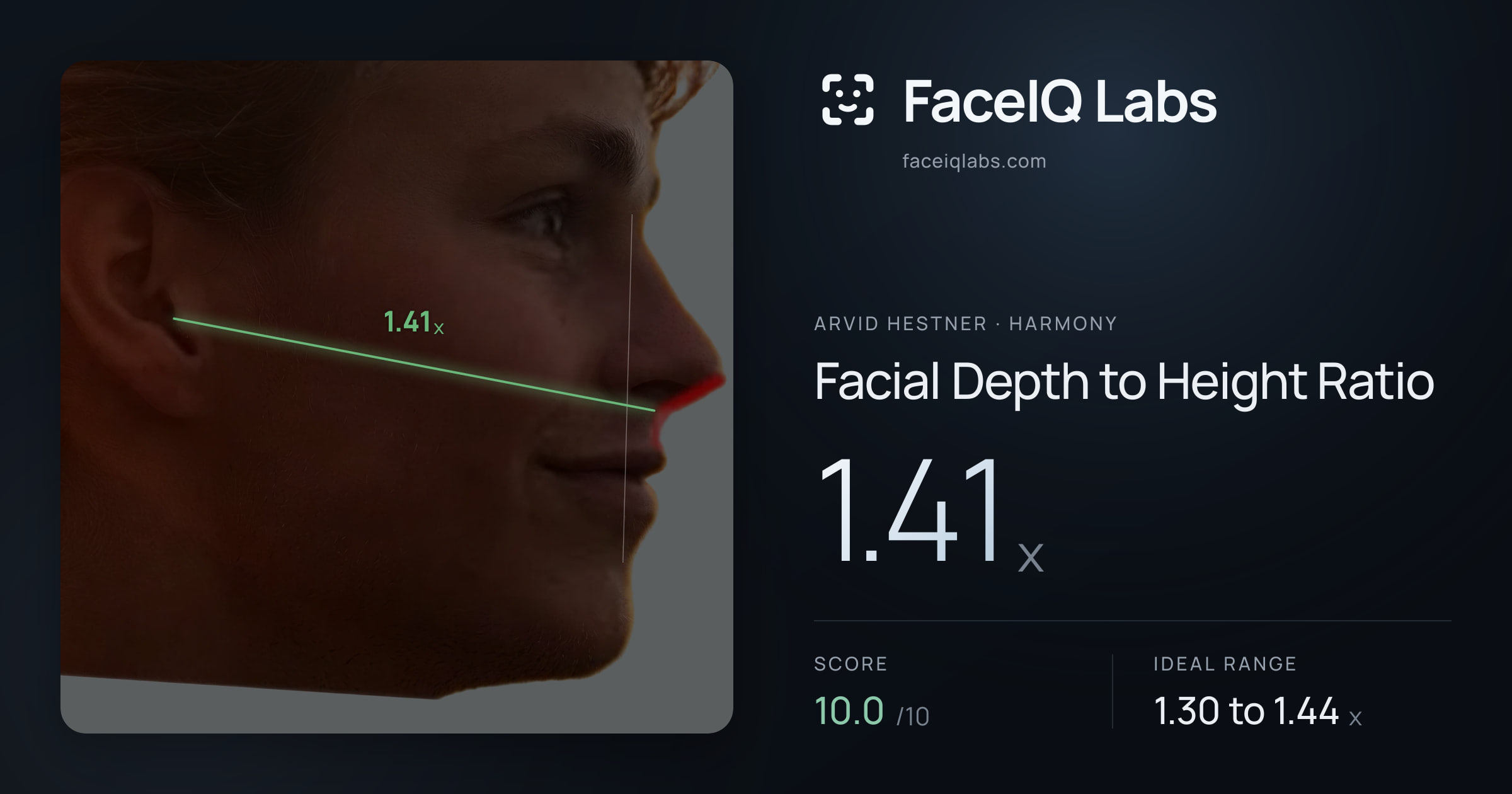 Arvid Hestner Facial Depth to Height Ratio: 1.41x, drawn on the photo