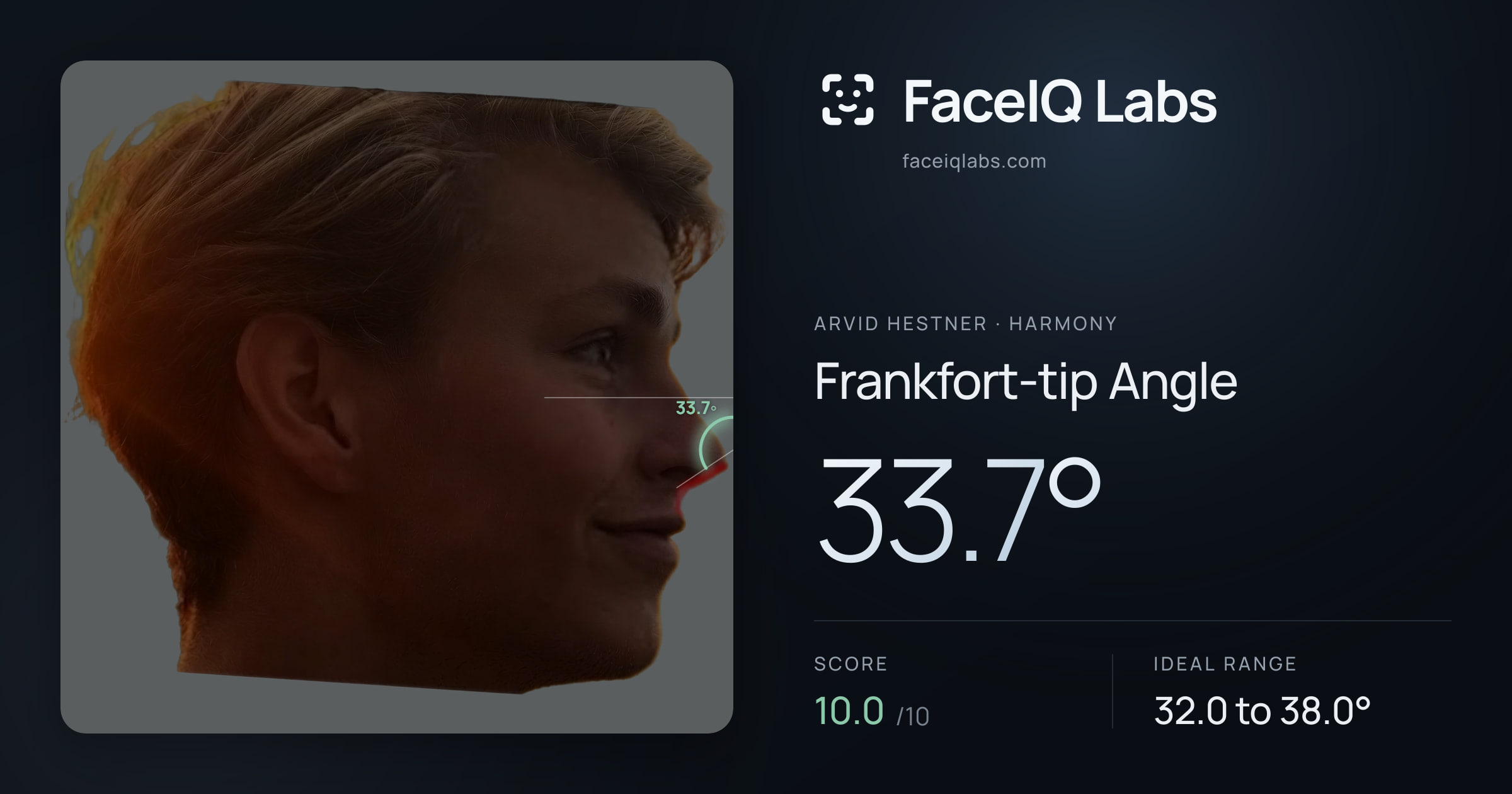 Arvid Hestner Frankfort-tip Angle: 33.7°, drawn on the photo