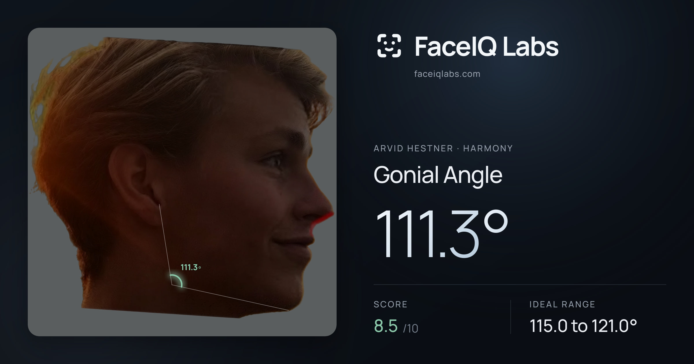 Arvid Hestner Gonial Angle: 111.3°, drawn on the photo
