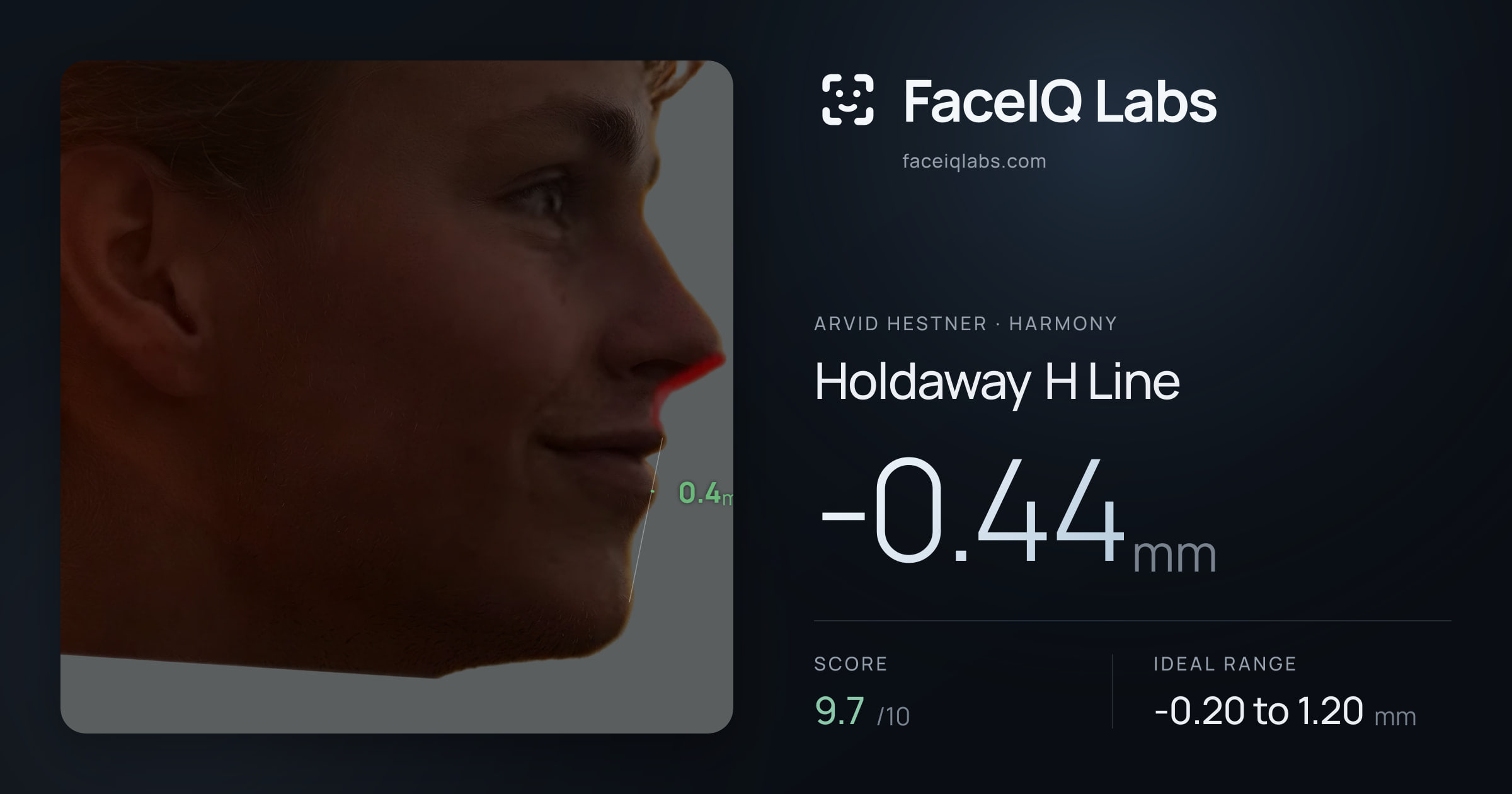 Arvid Hestner Holdaway H Line: -0.44mm, drawn on the photo