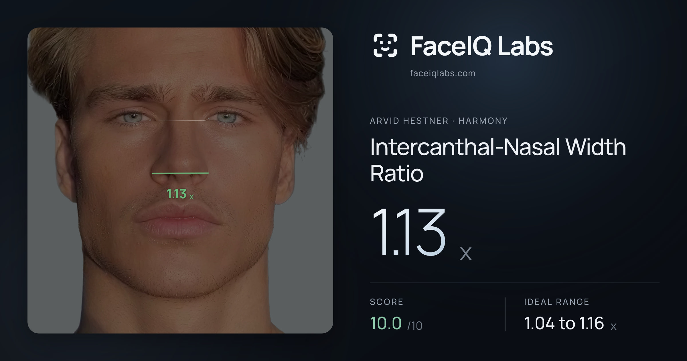 Arvid Hestner Intercanthal-Nasal Width Ratio: 1.13x, drawn on the photo
