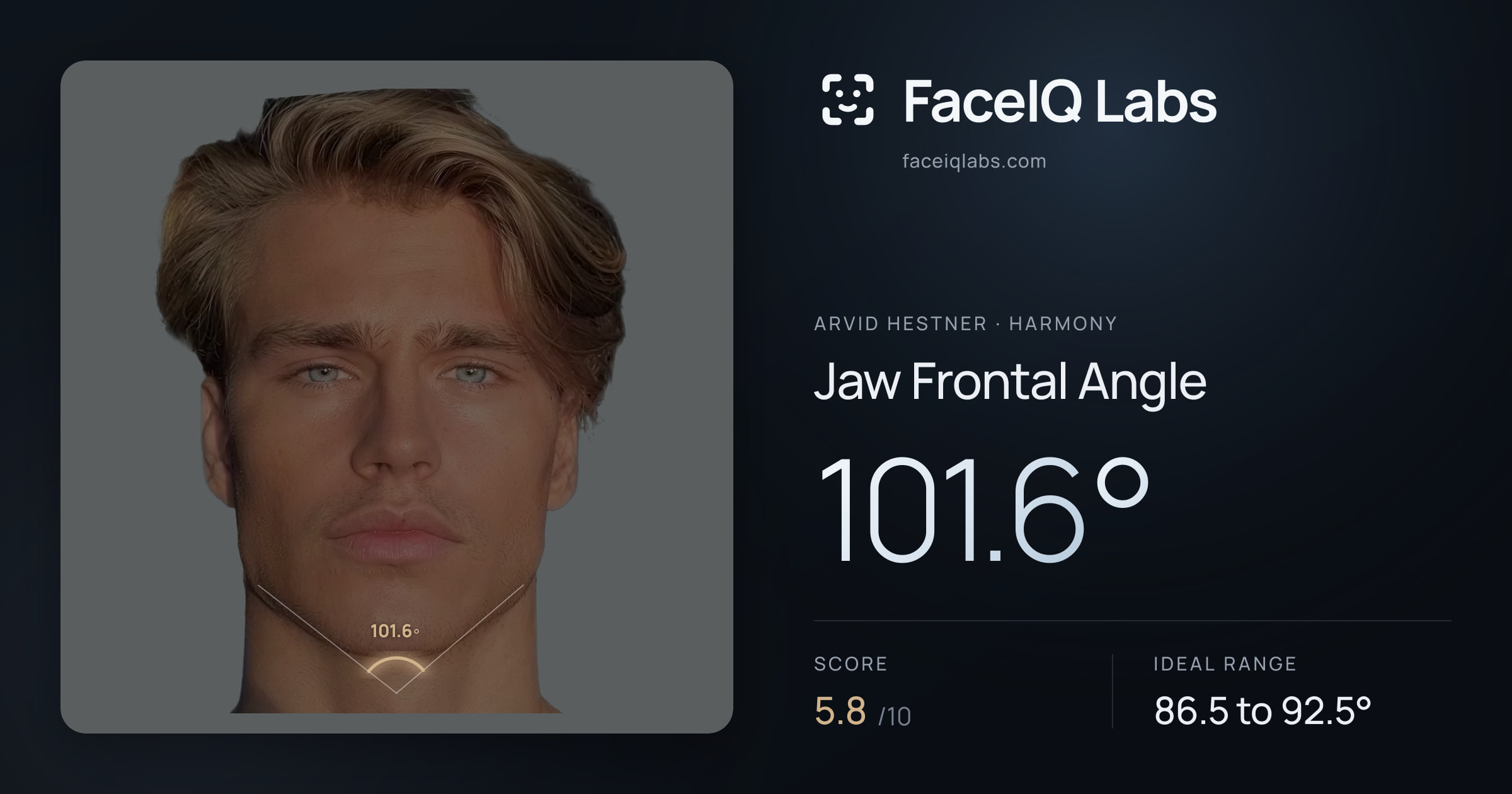 Arvid Hestner Jaw Frontal Angle: 101.6°, drawn on the photo