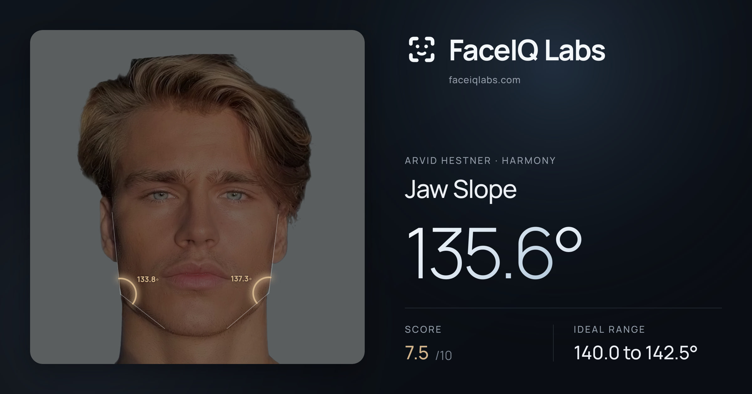 Arvid Hestner Jaw Slope: 135.6°, drawn on the photo