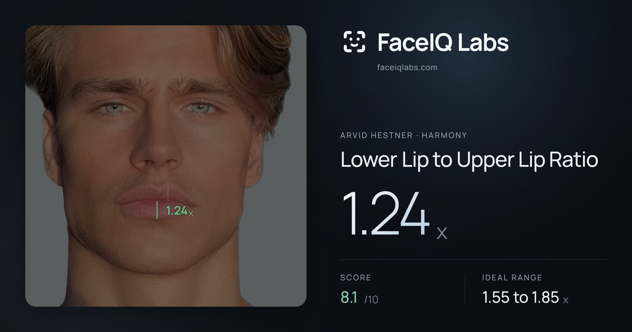 Arvid Hestner Lower Lip to Upper Lip Ratio: 1.24x, drawn on the photo
