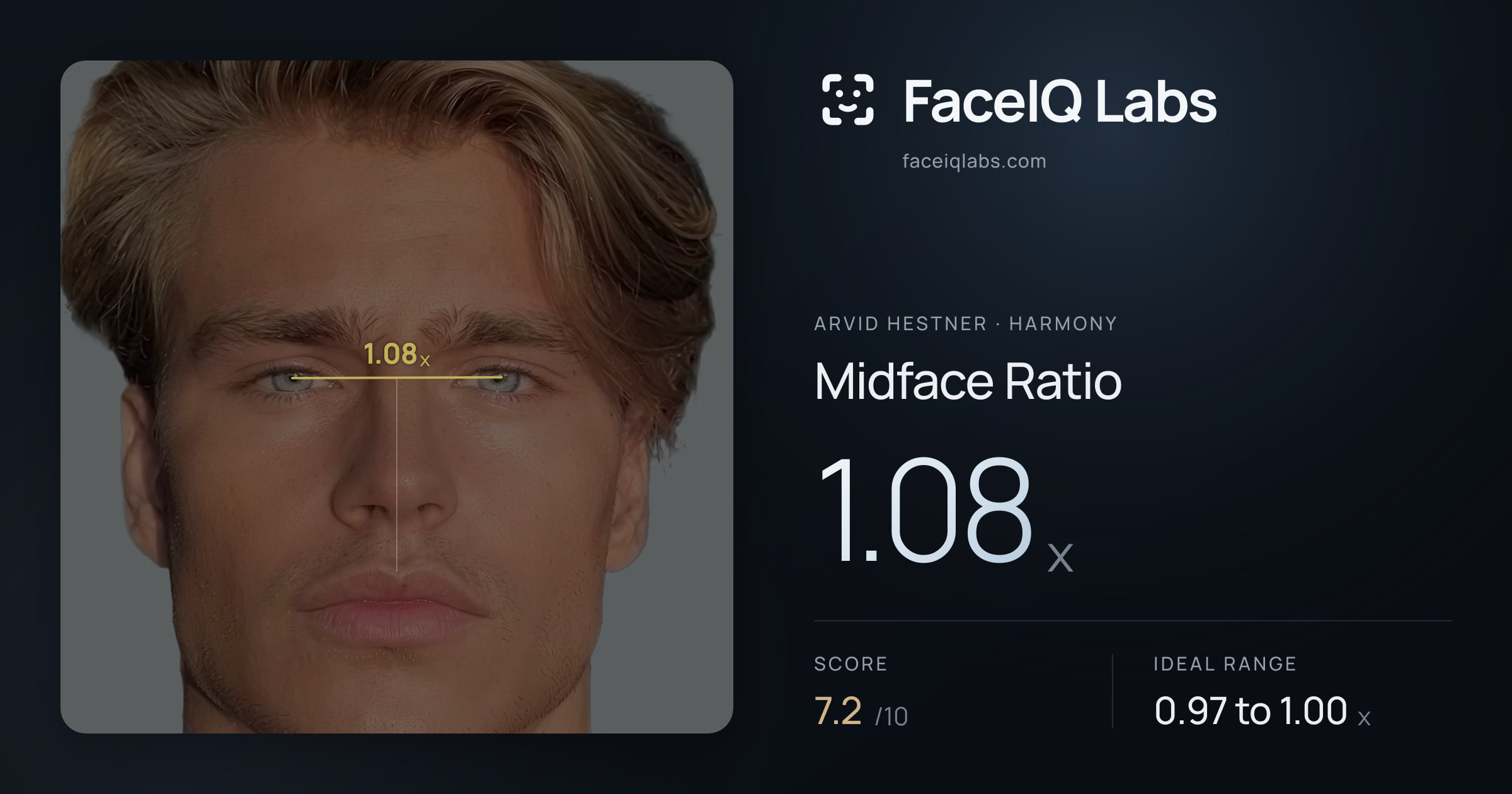 Arvid Hestner Midface Ratio: 1.08x, drawn on the photo