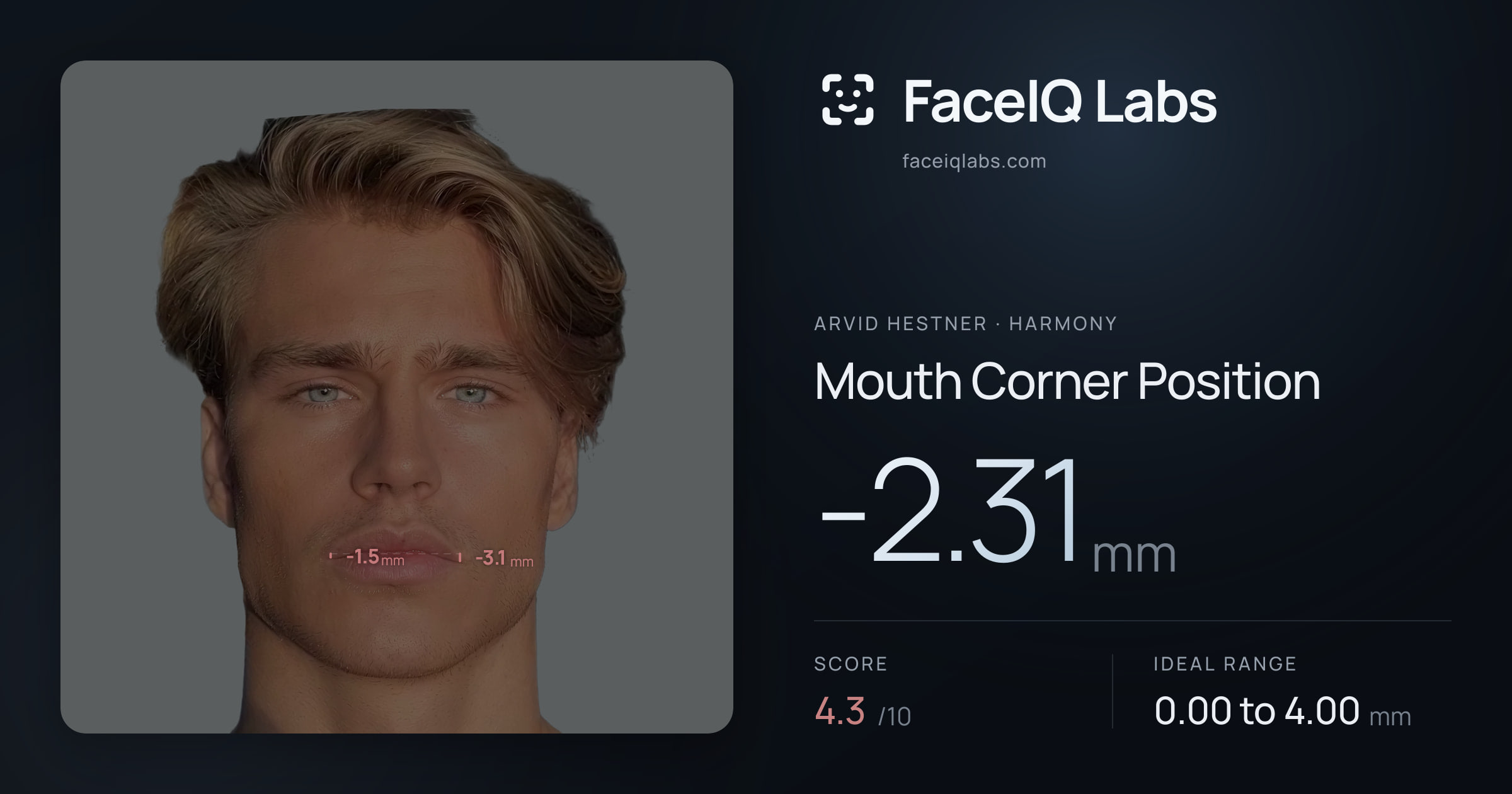 Arvid Hestner Mouth Corner Position: -2.31mm, drawn on the photo