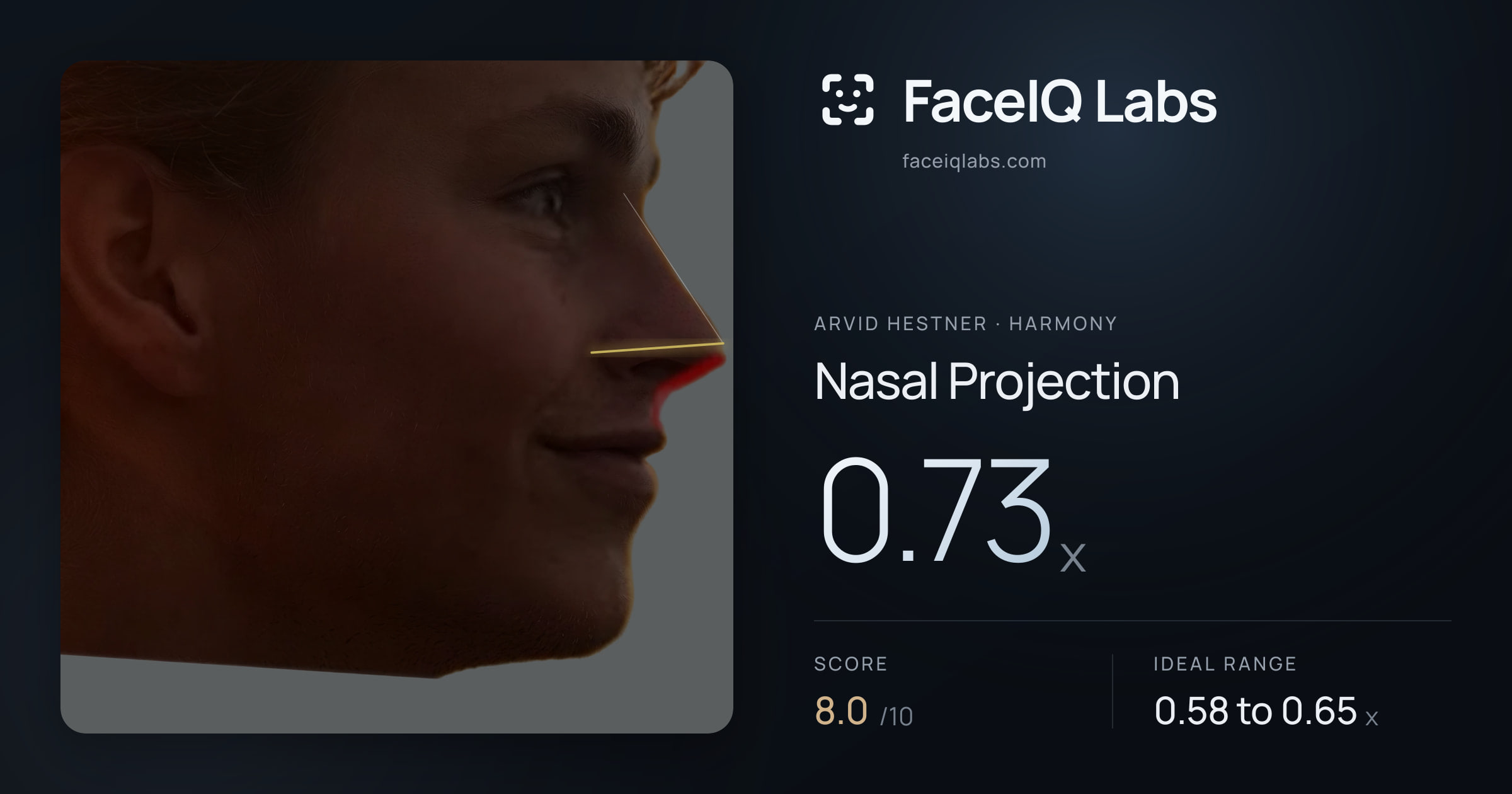 Arvid Hestner Nasal Projection: 0.73x, drawn on the photo