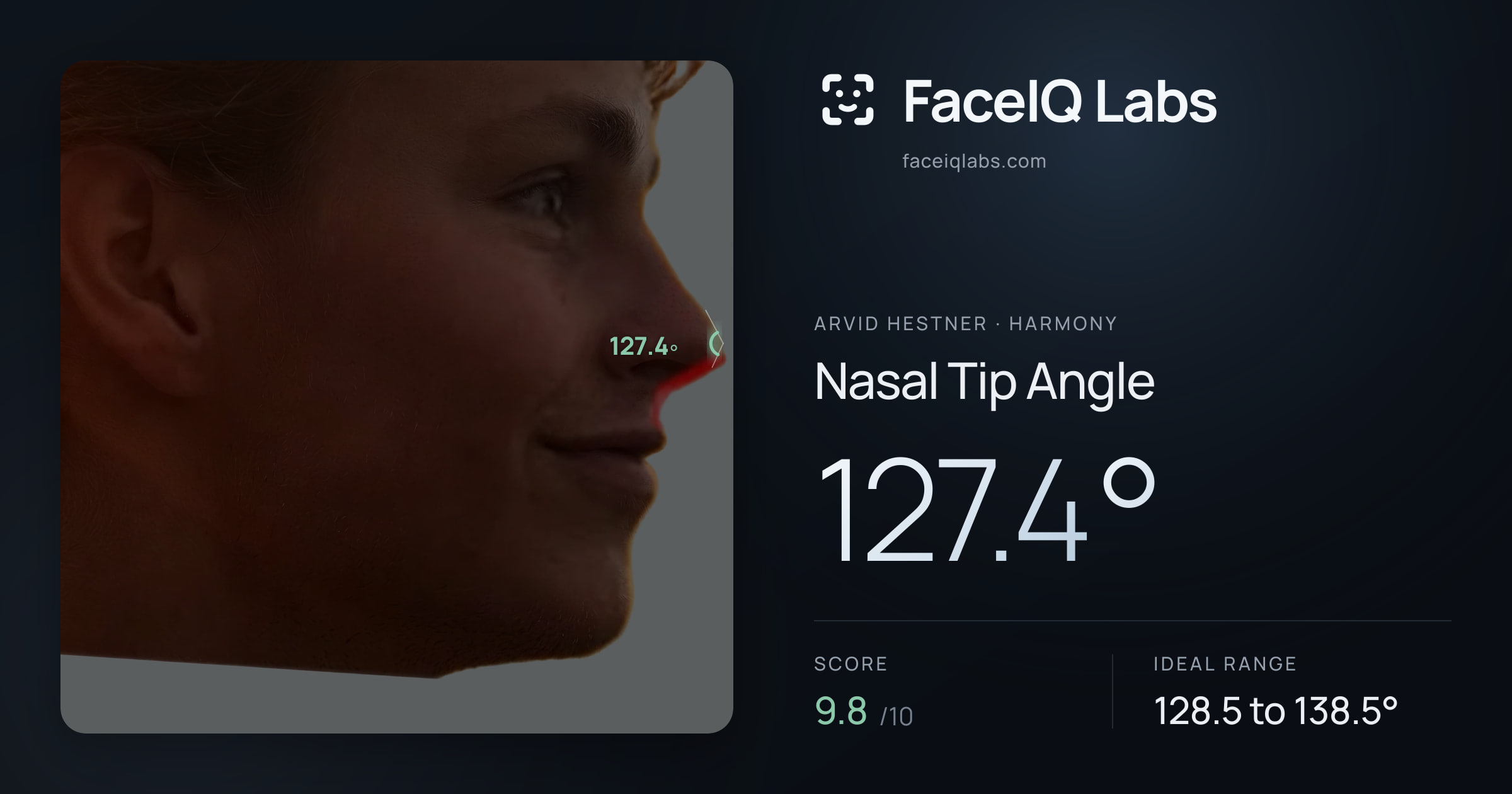 Arvid Hestner Nasal Tip Angle: 127.4°, drawn on the photo