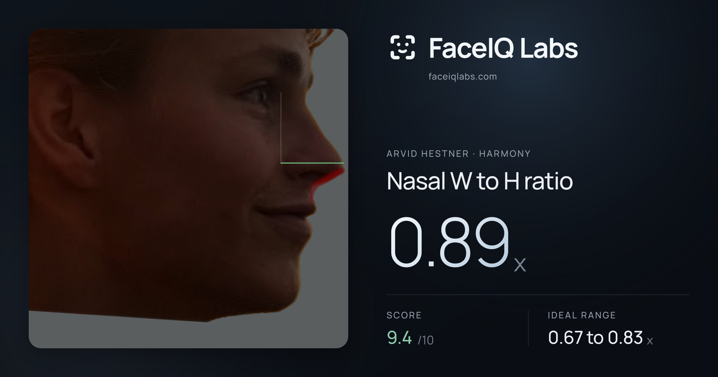 Arvid Hestner Nasal W to H ratio: 0.89x, drawn on the photo
