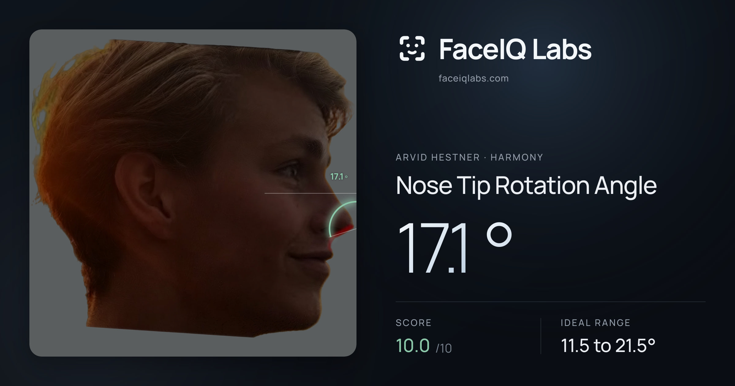 Arvid Hestner Nose Tip Rotation Angle: 17.1°, drawn on the photo
