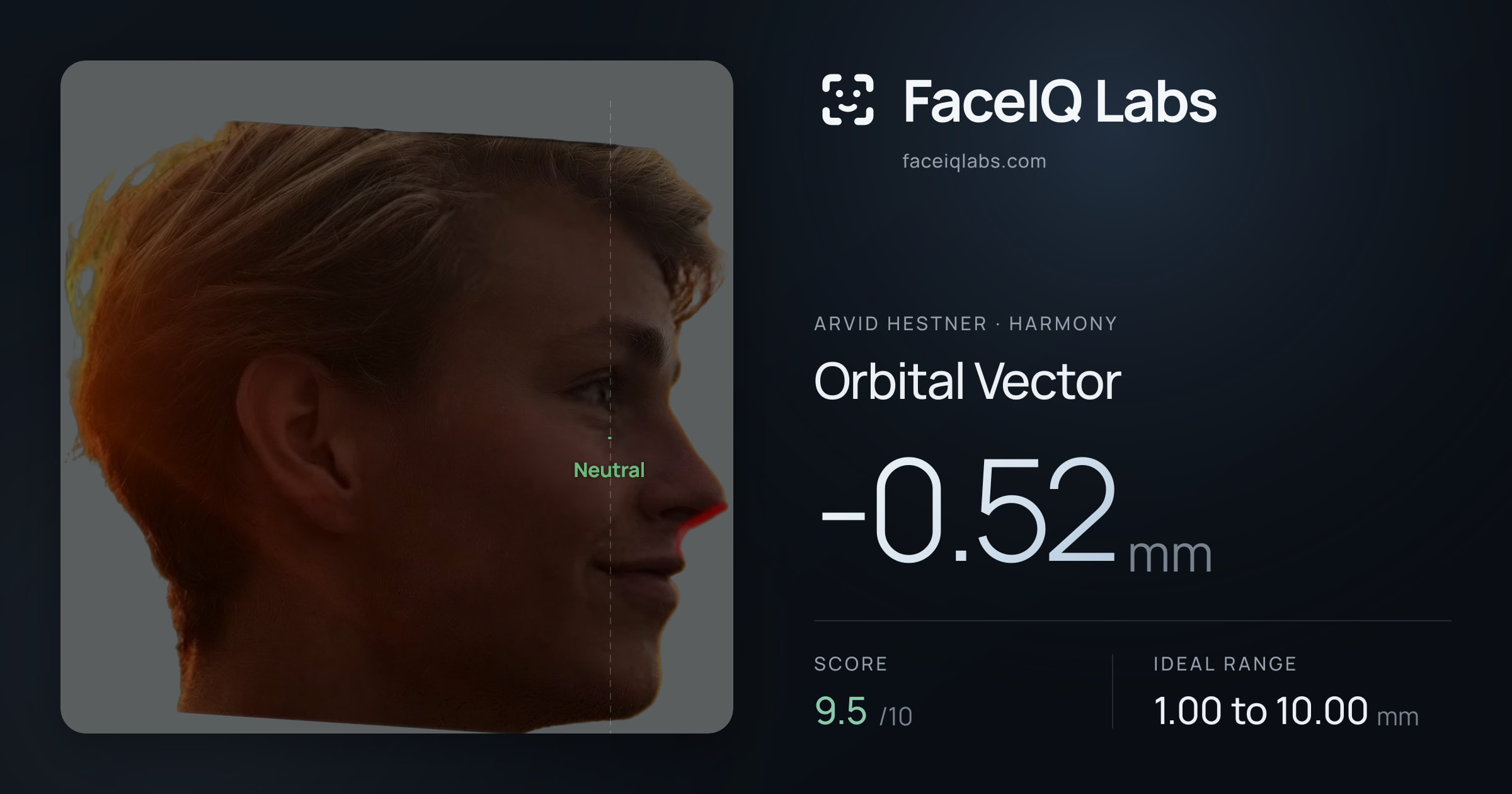 Arvid Hestner Orbital Vector: -0.52mm, drawn on the photo
